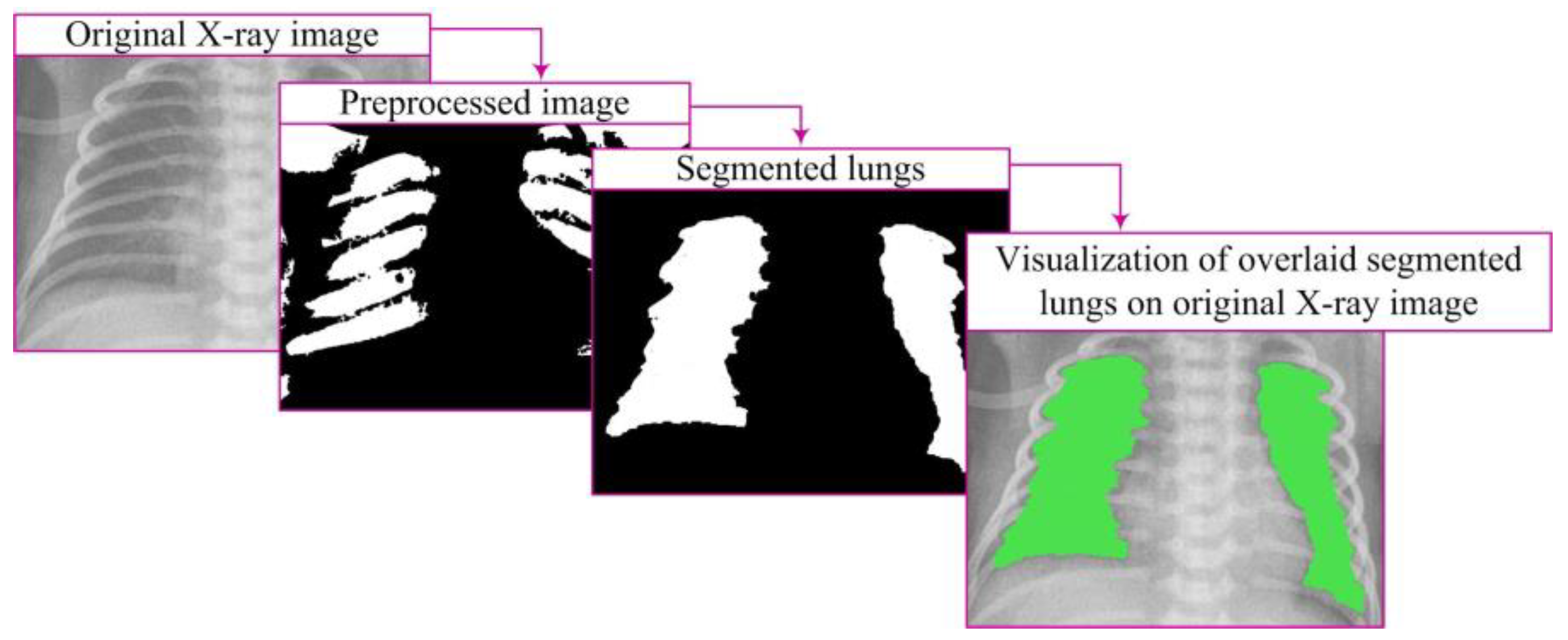 Diagnostics 14 00214 g006