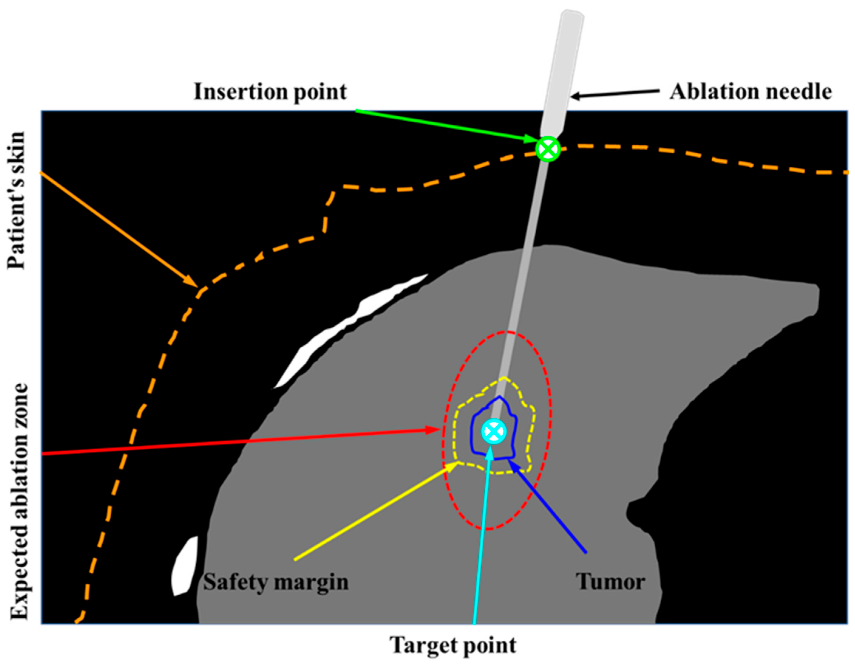Diagnostics | Free Full-Text | An Automatic Needle Puncture Path ...