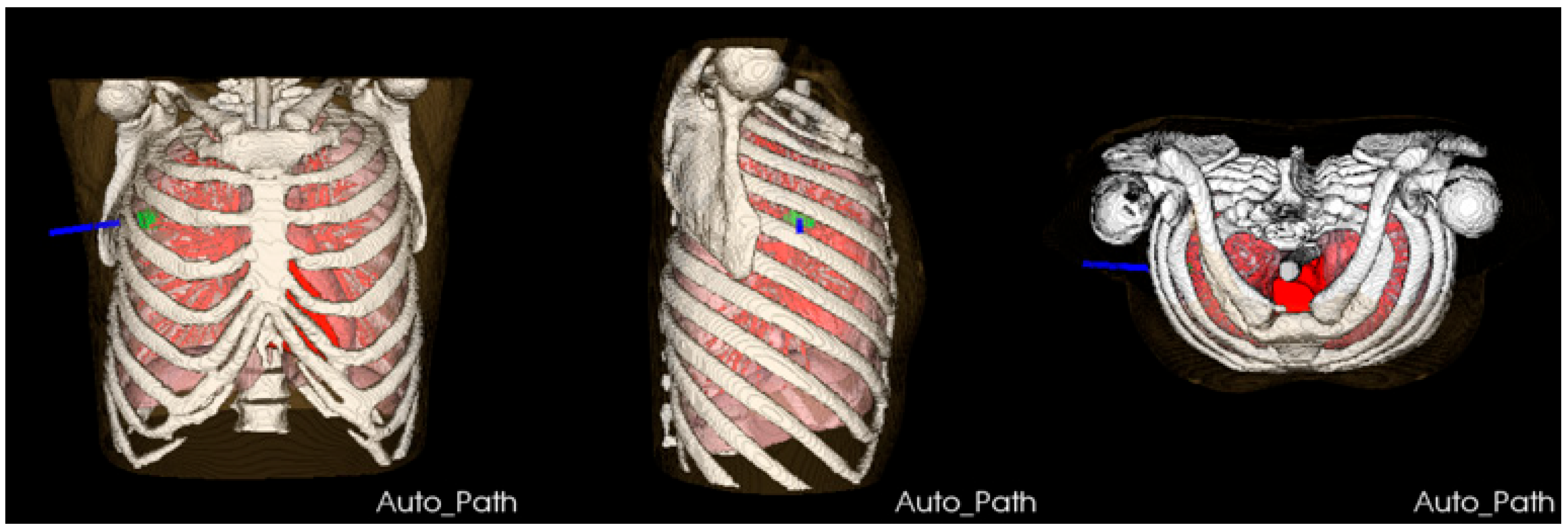 Diagnostics 14 00215 g011