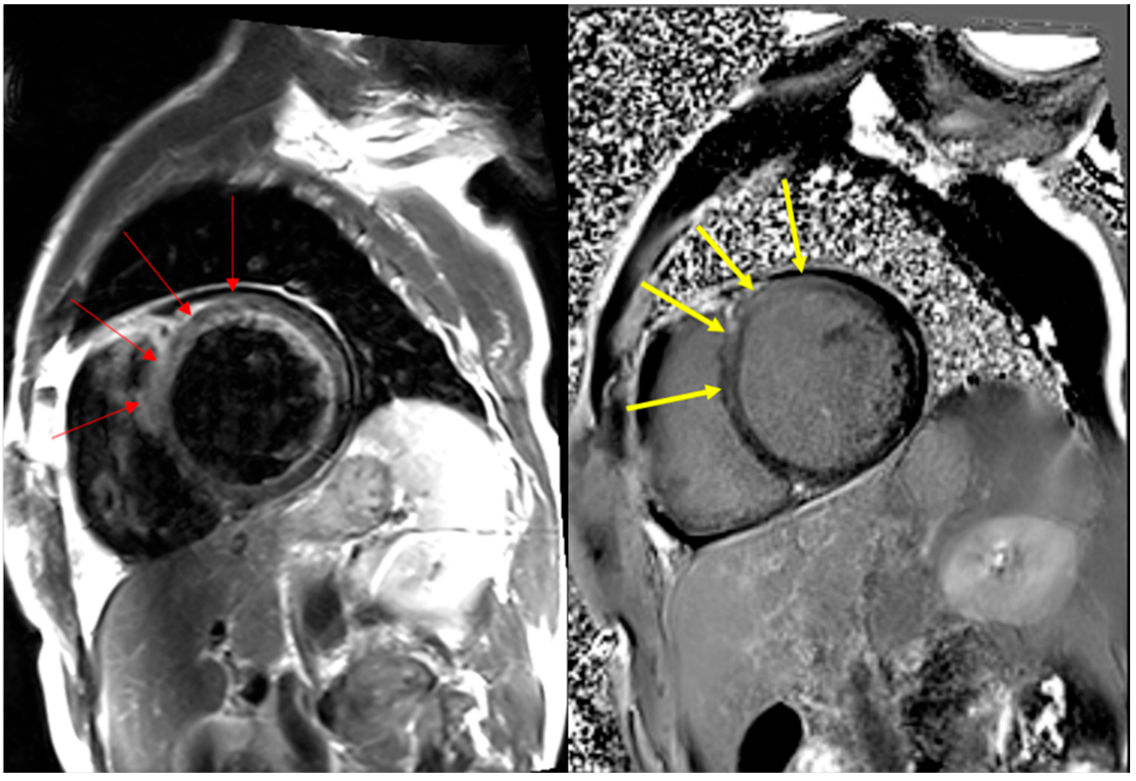 Diagnostics 14 00219 g001
