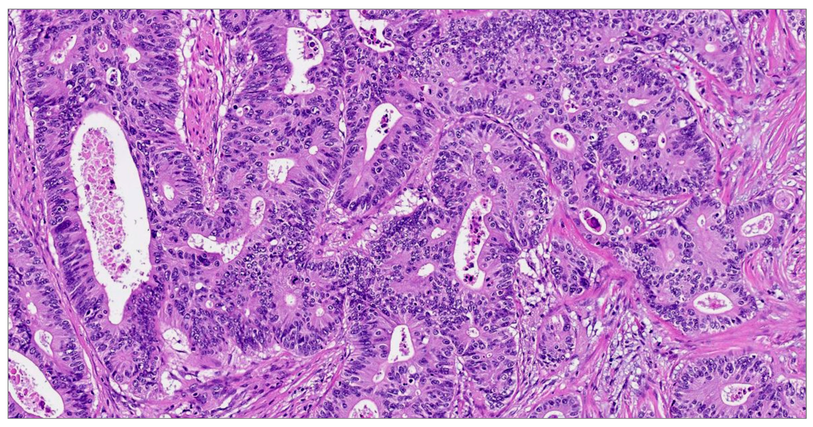 Diagnostics 14 00220 g001 Diagnostics 14 00220 g001