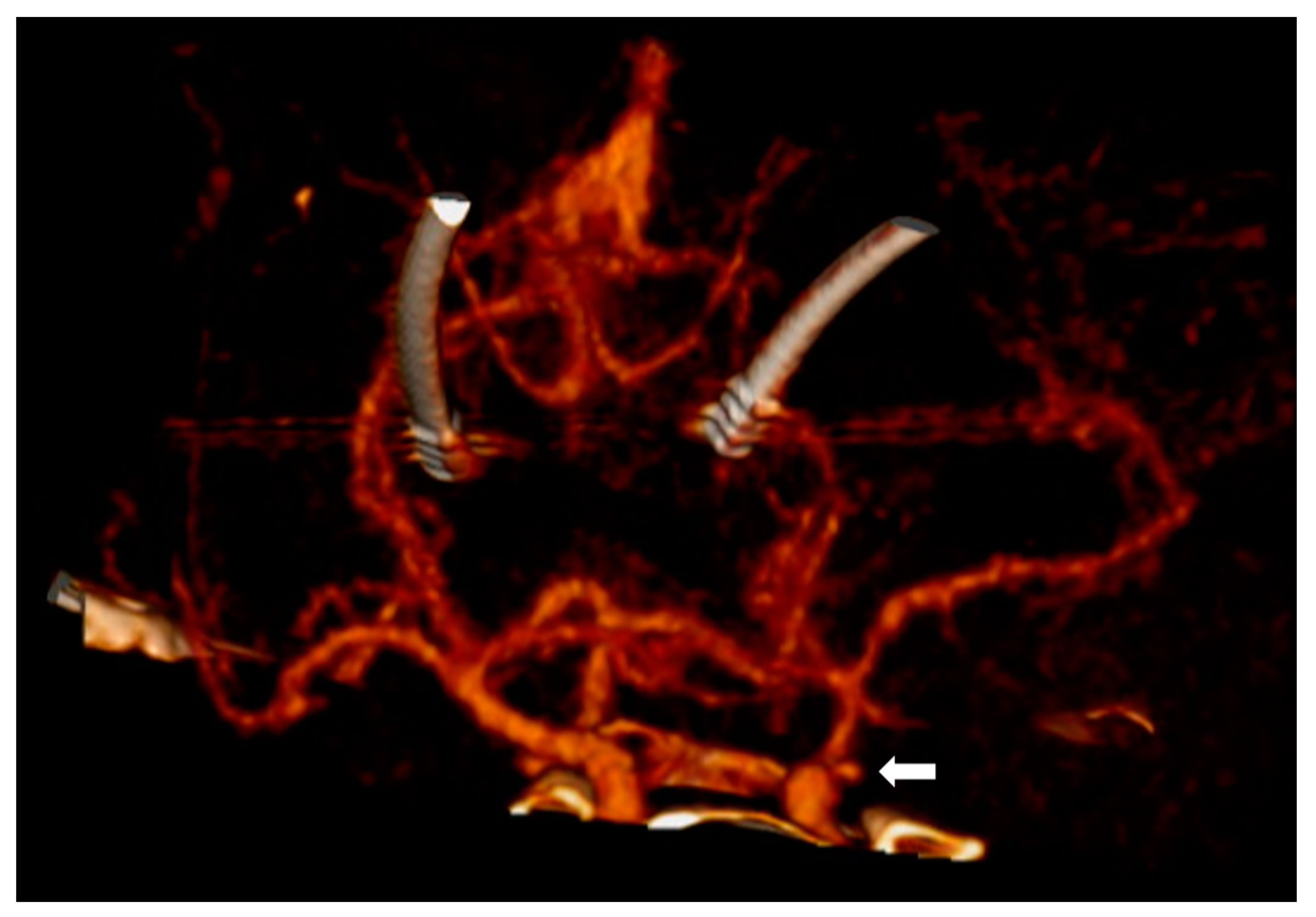 Diagnostics 14 00222 g003