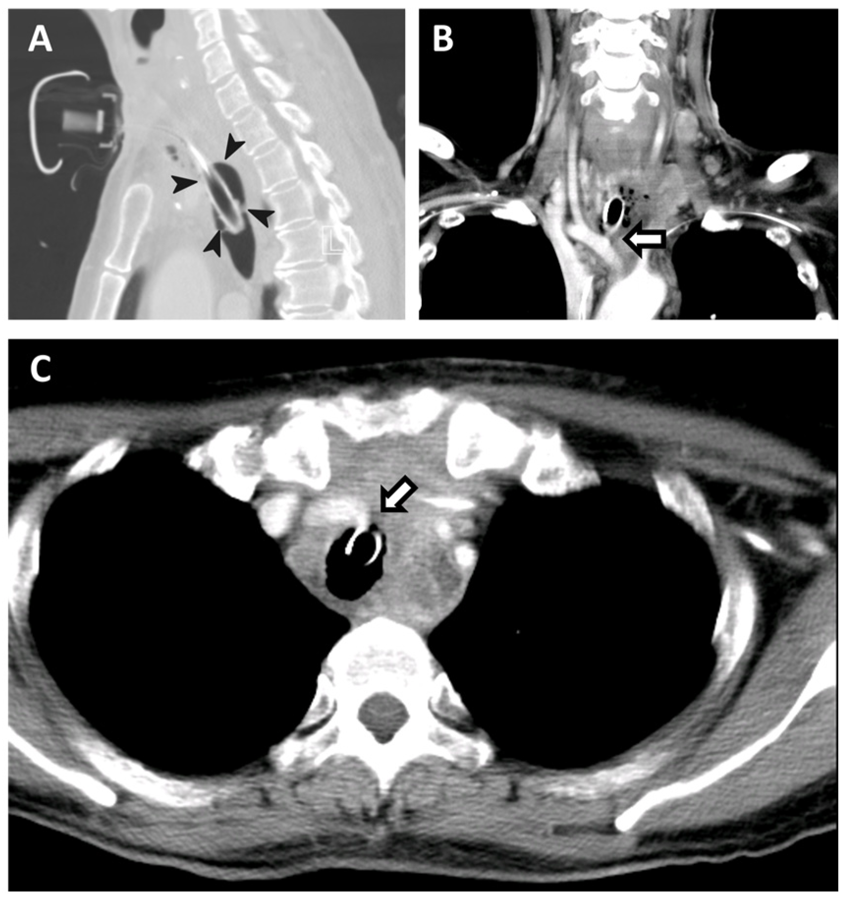Diagnostics 14 00223 g001