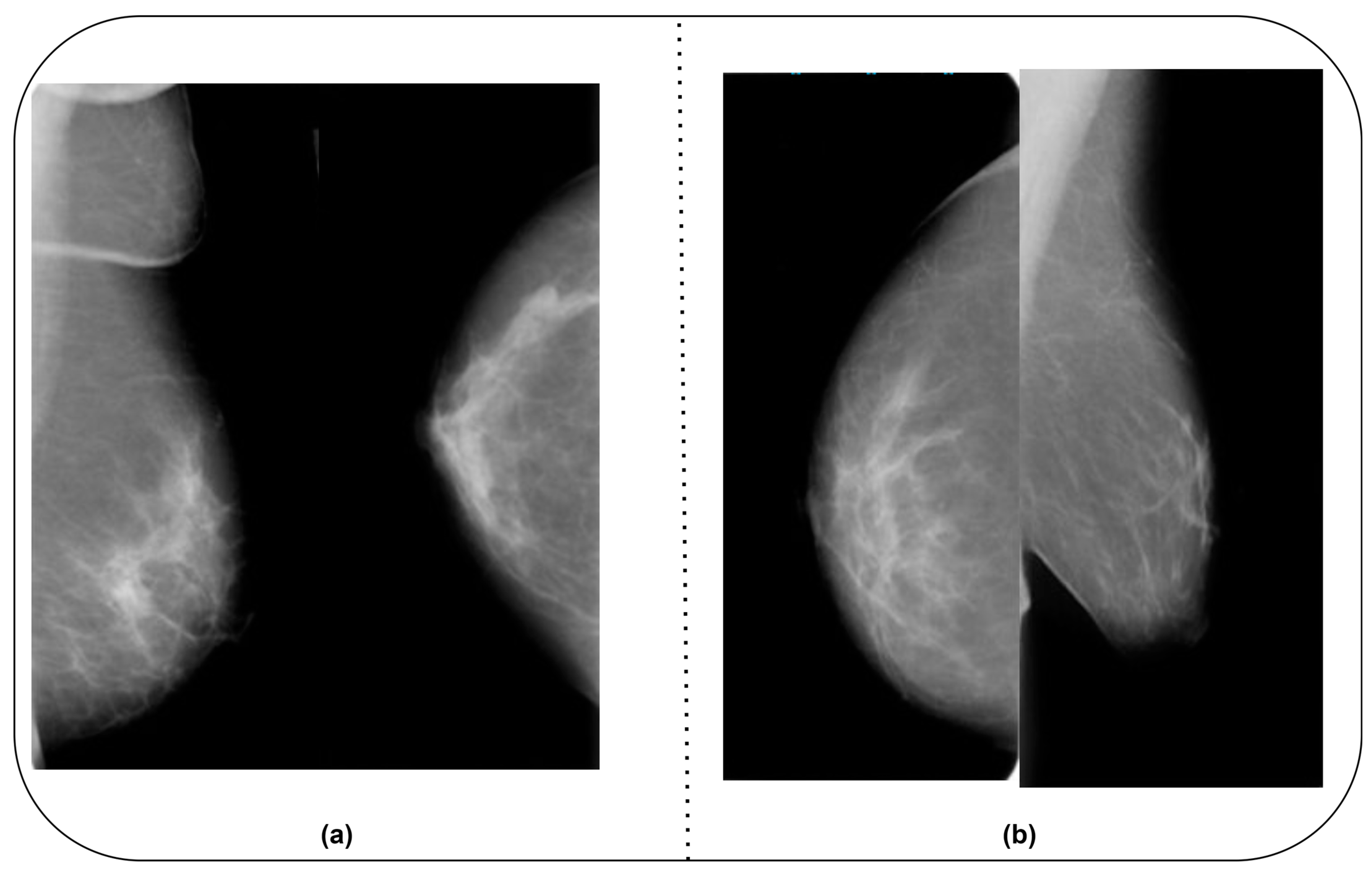 Diagnostics 14 00227 g002