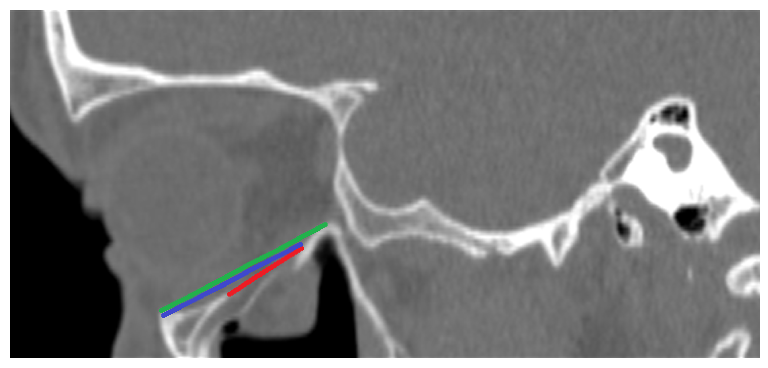Diagnostics 14 00245 g001