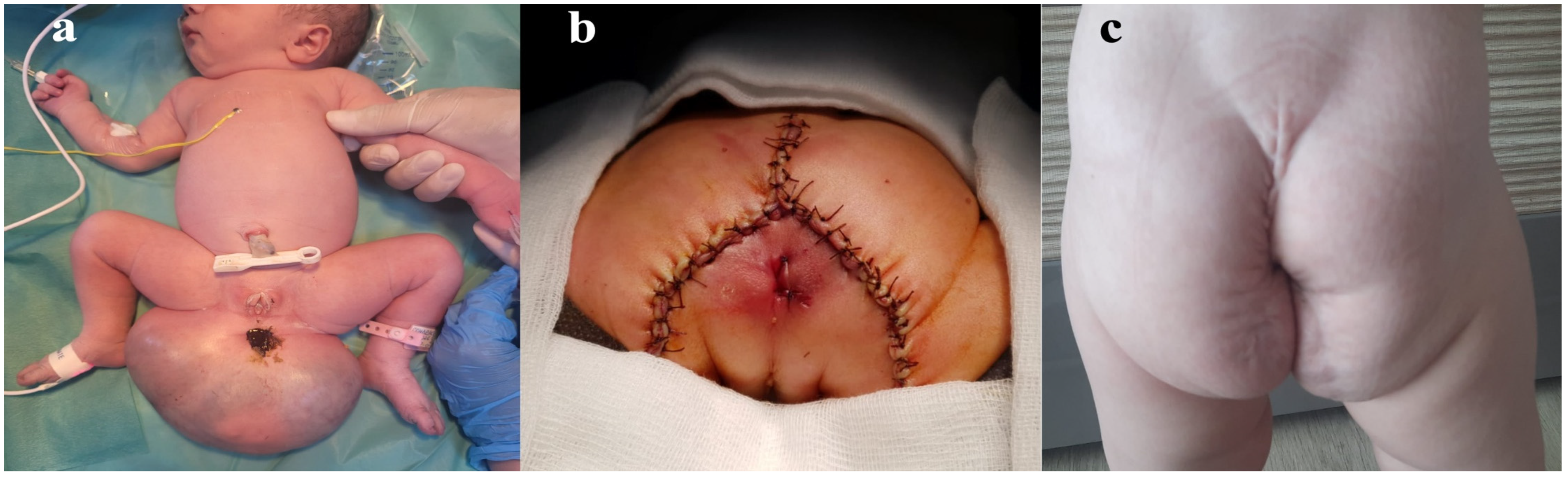 Diagnostics 14 00246 g004 Diagnostics 14 00246 g004