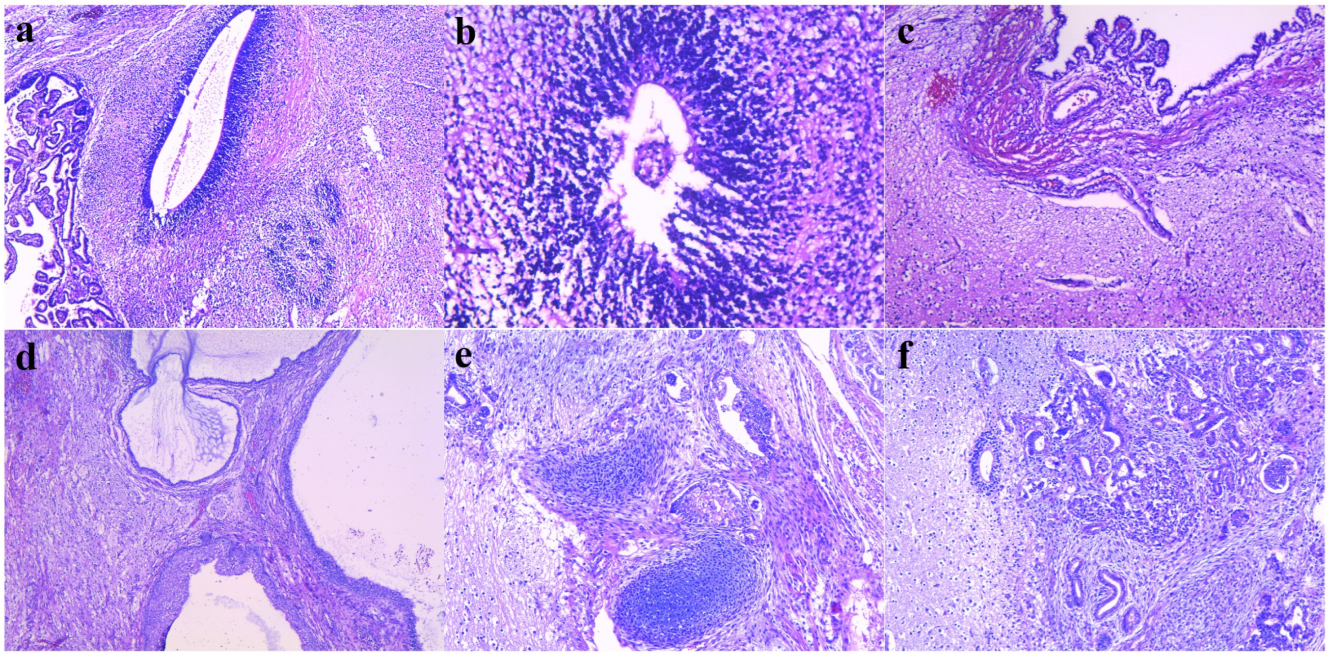 Diagnostics 14 00246 g005 Diagnostics 14 00246 g005