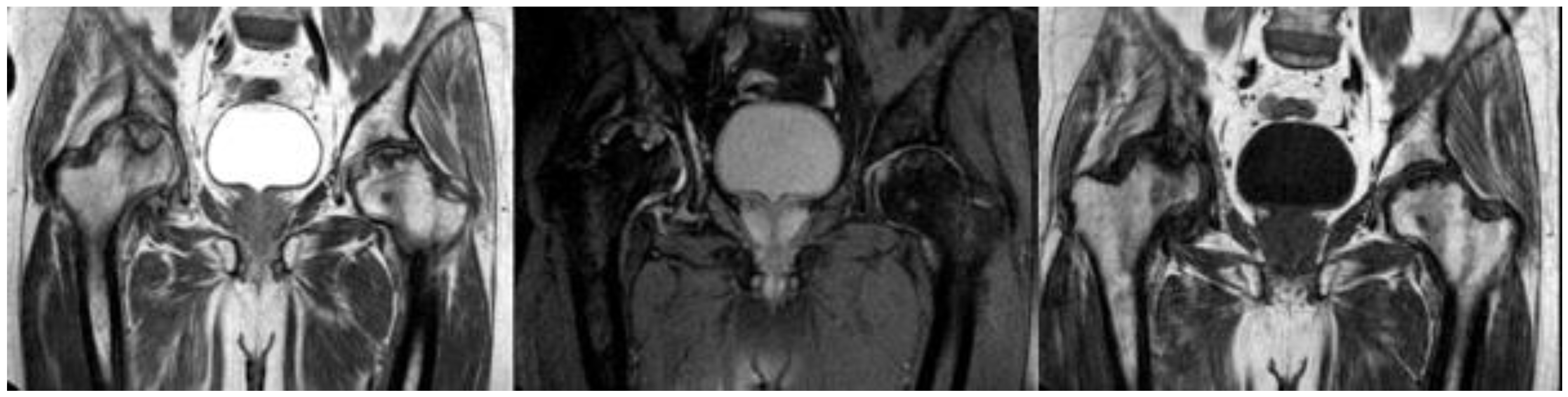 Diagnostics 14 00247 g001