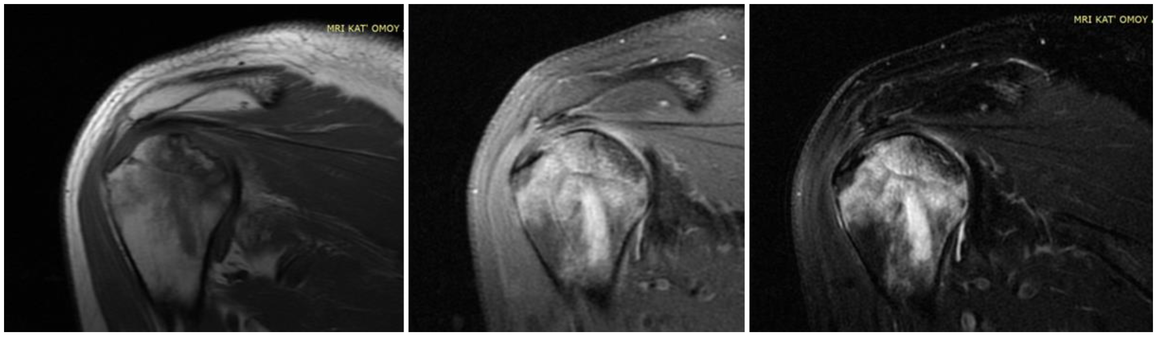 Diagnostics 14 00247 g003