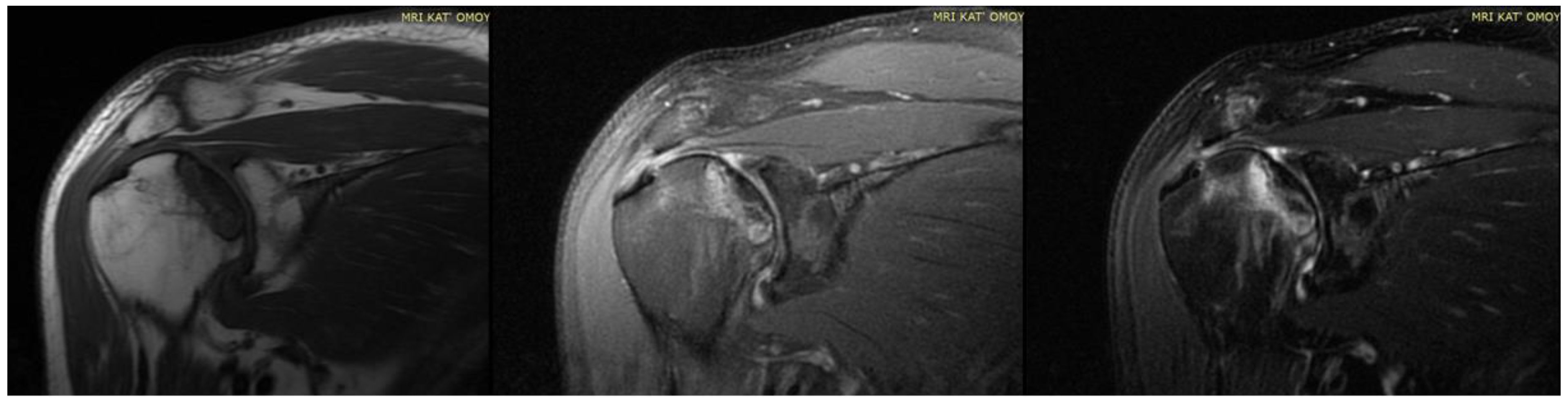 Diagnostics 14 00247 g004