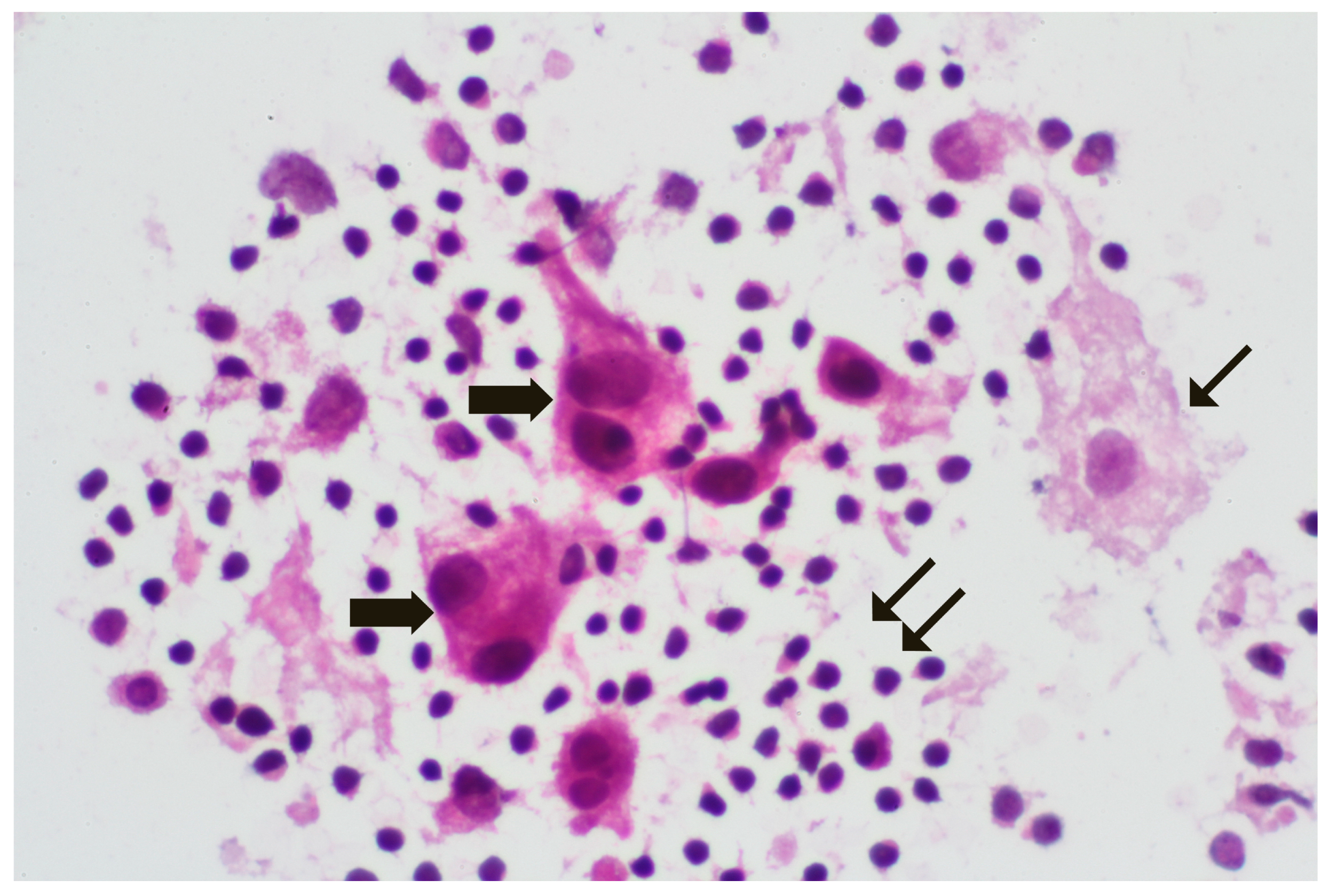 Diagnostics 14 00252 g003