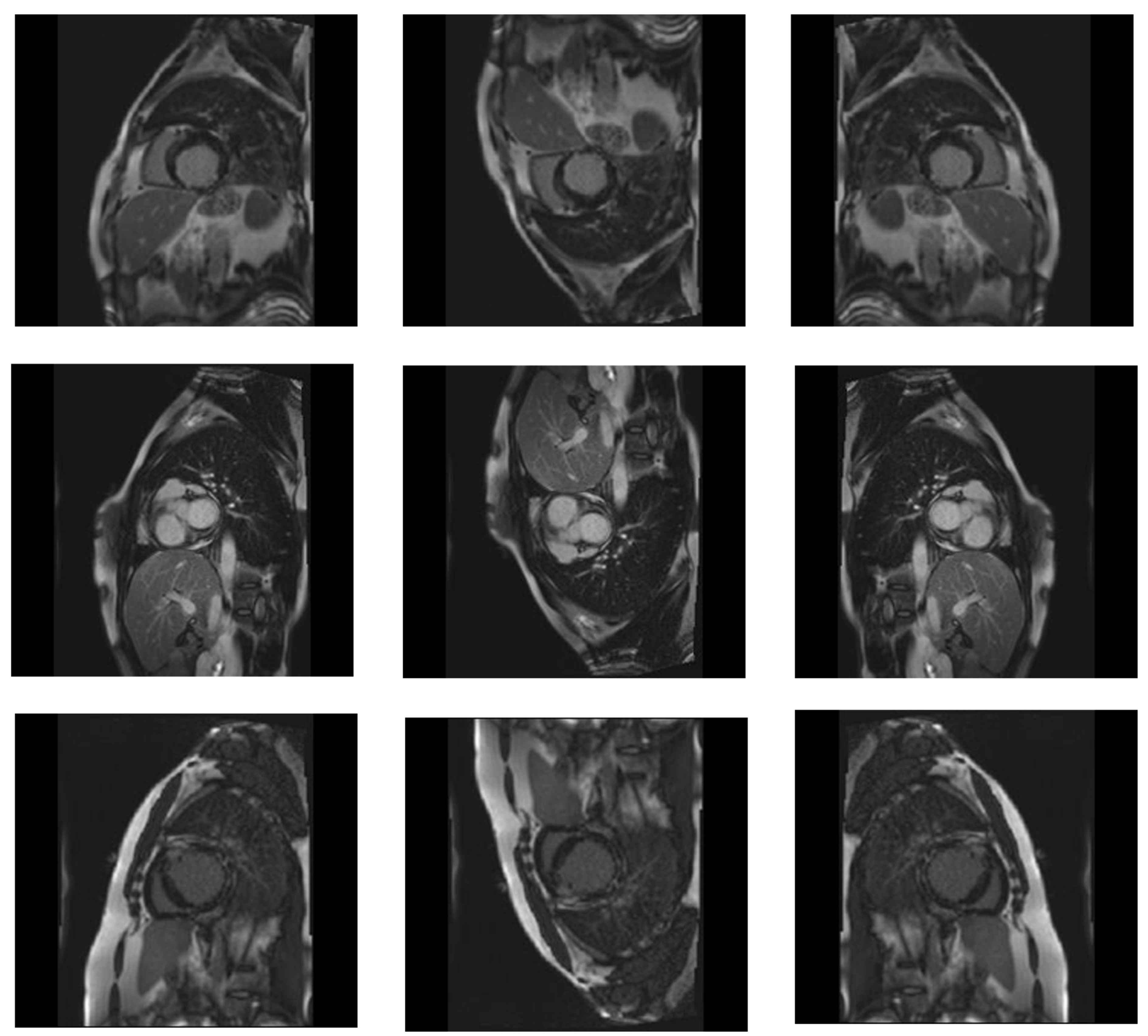 Diagnostics 14 00255 g003