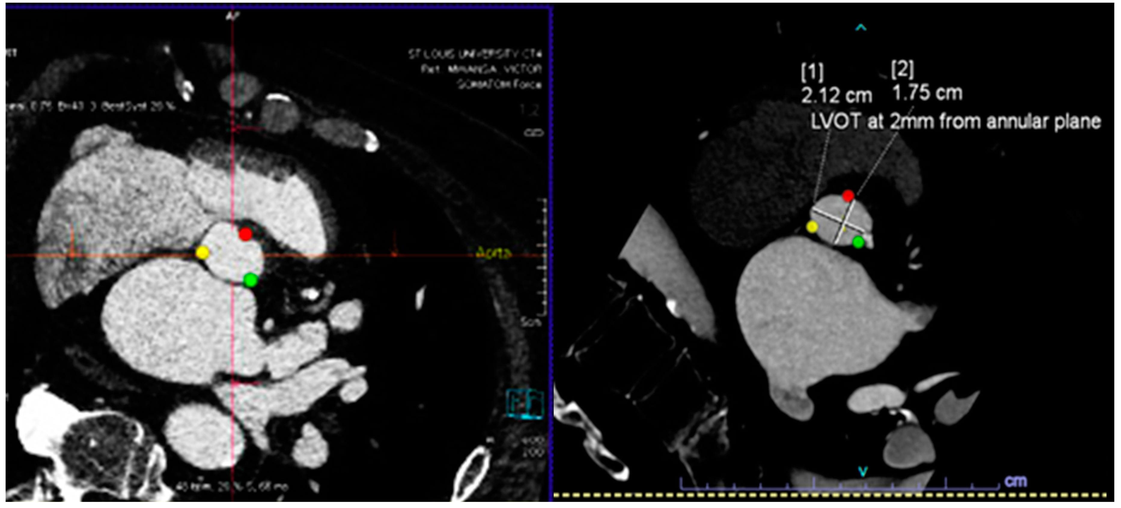 Diagnostics 14 00261 g001a