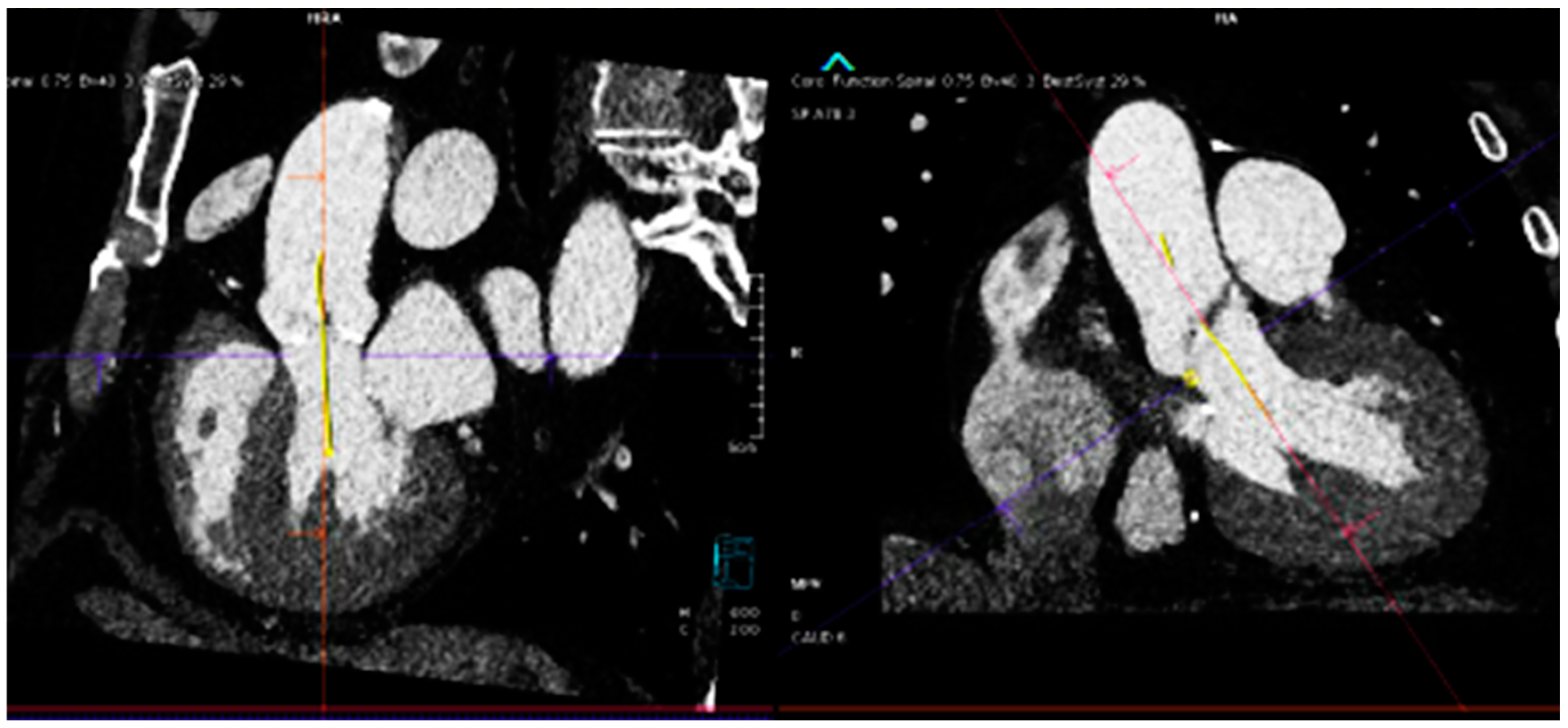 Diagnostics 14 00261 g001b