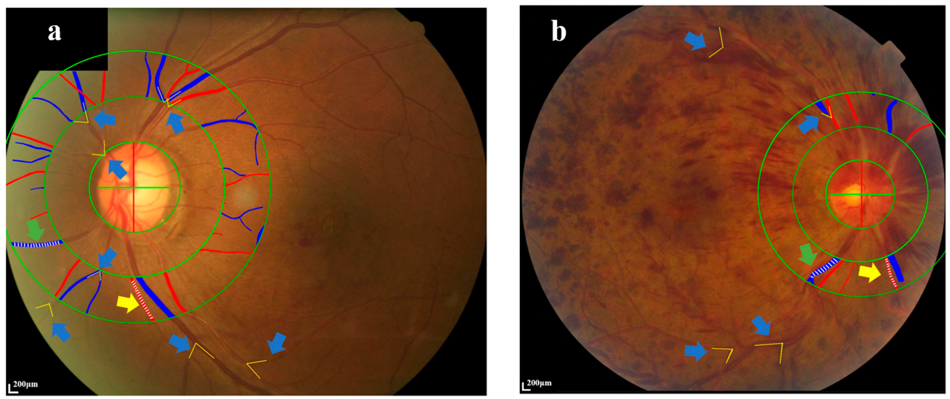 Diagnostics 14 00267 g002