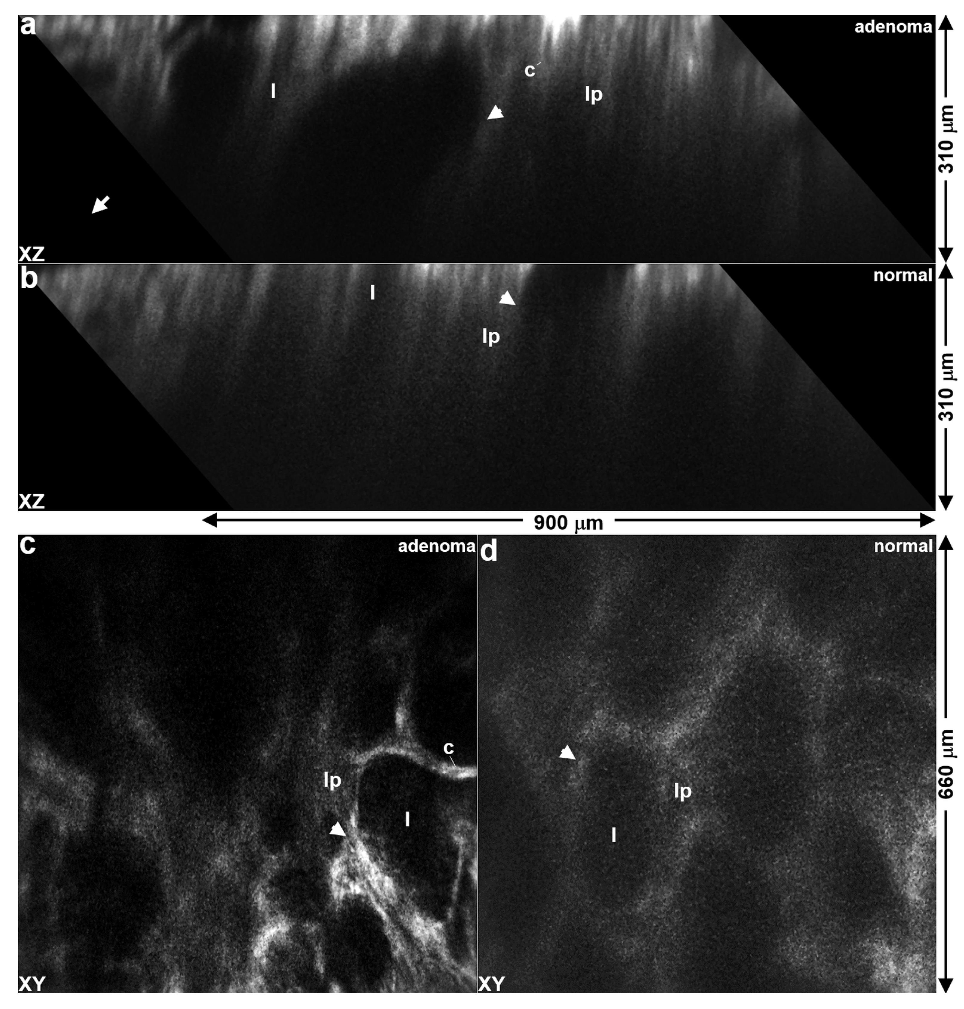 Diagnostics 14 00273 g005