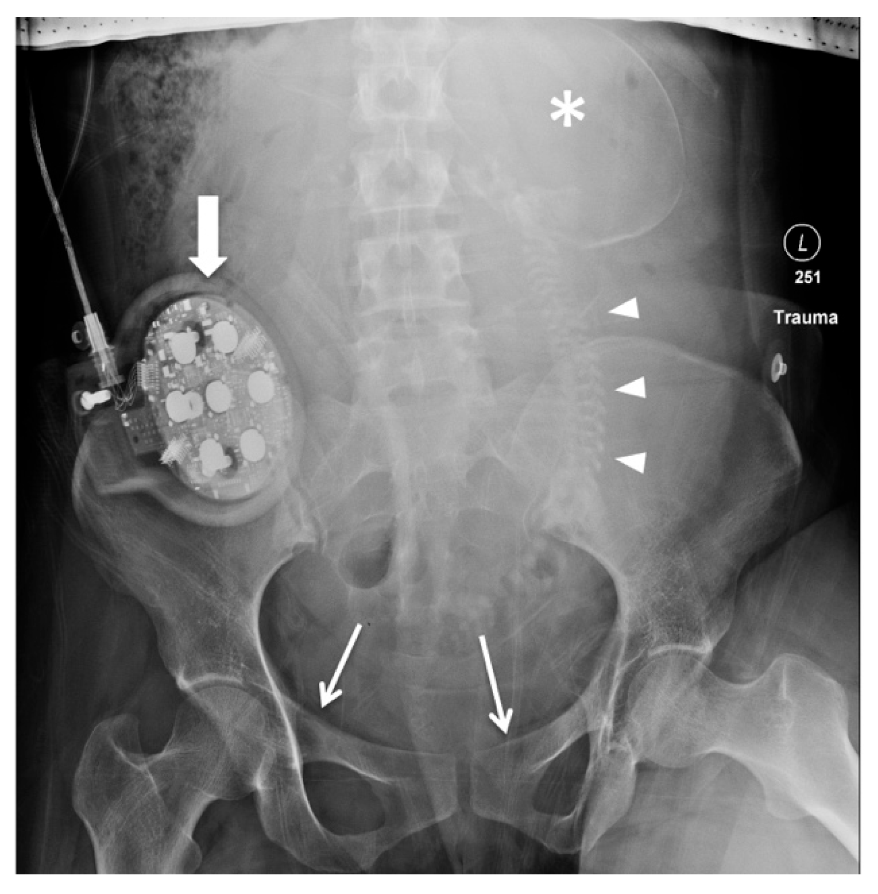 Diagnostics 14 00276 g001