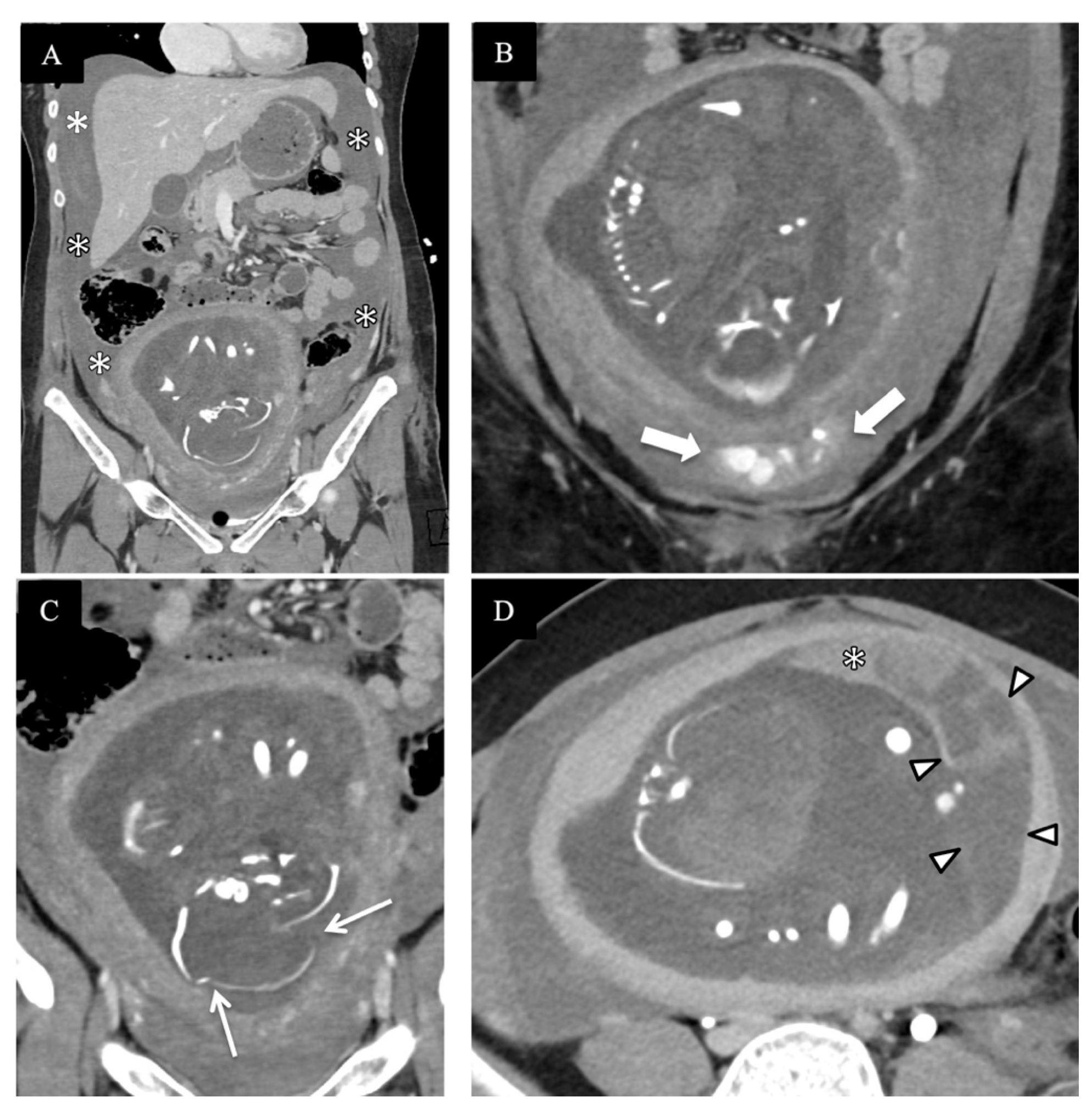 Diagnostics 14 00276 g004