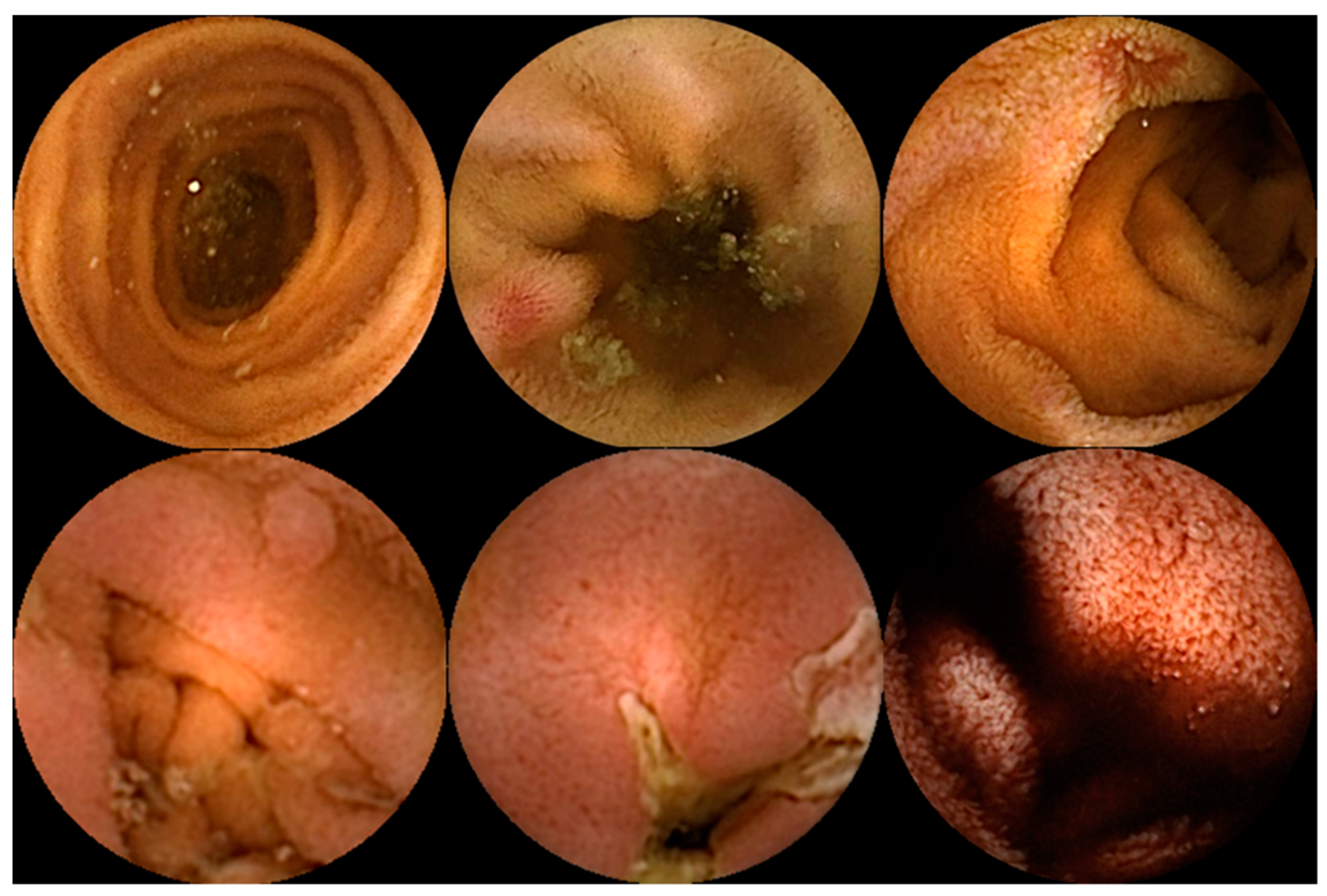 Diagnostics 14 00291 g001