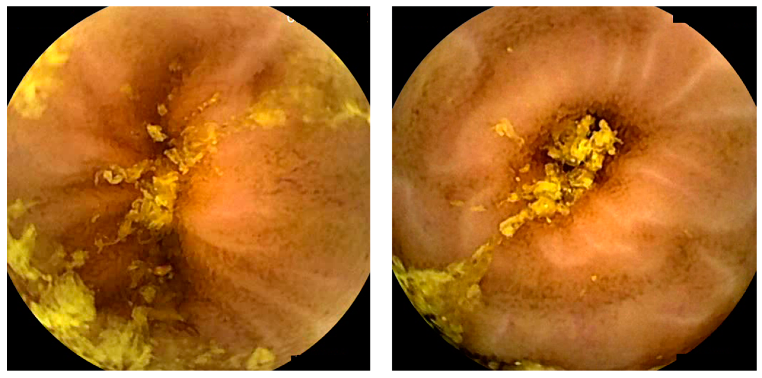 Diagnostics 14 00291 g002