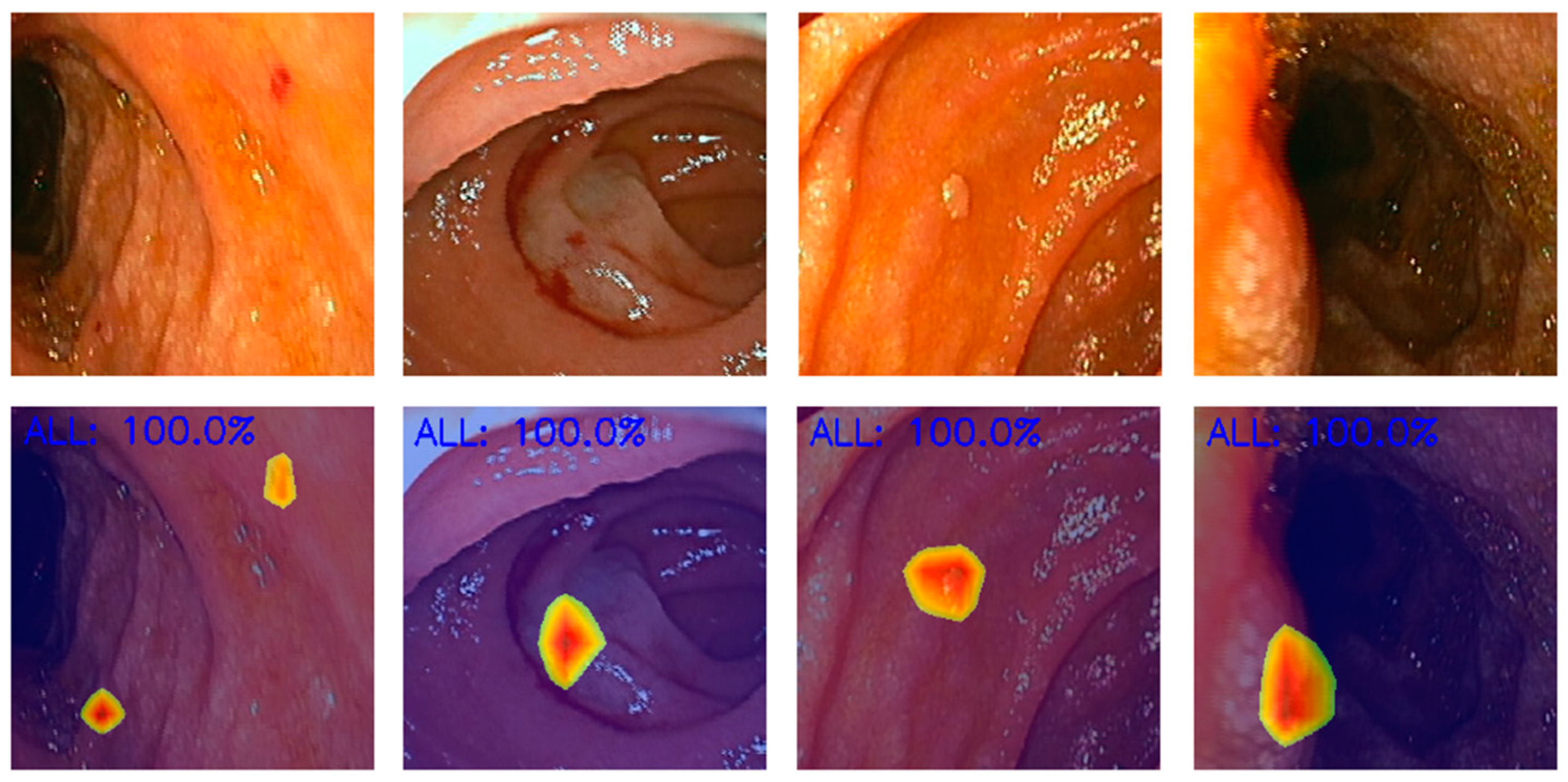 Diagnostics 14 00291 g004