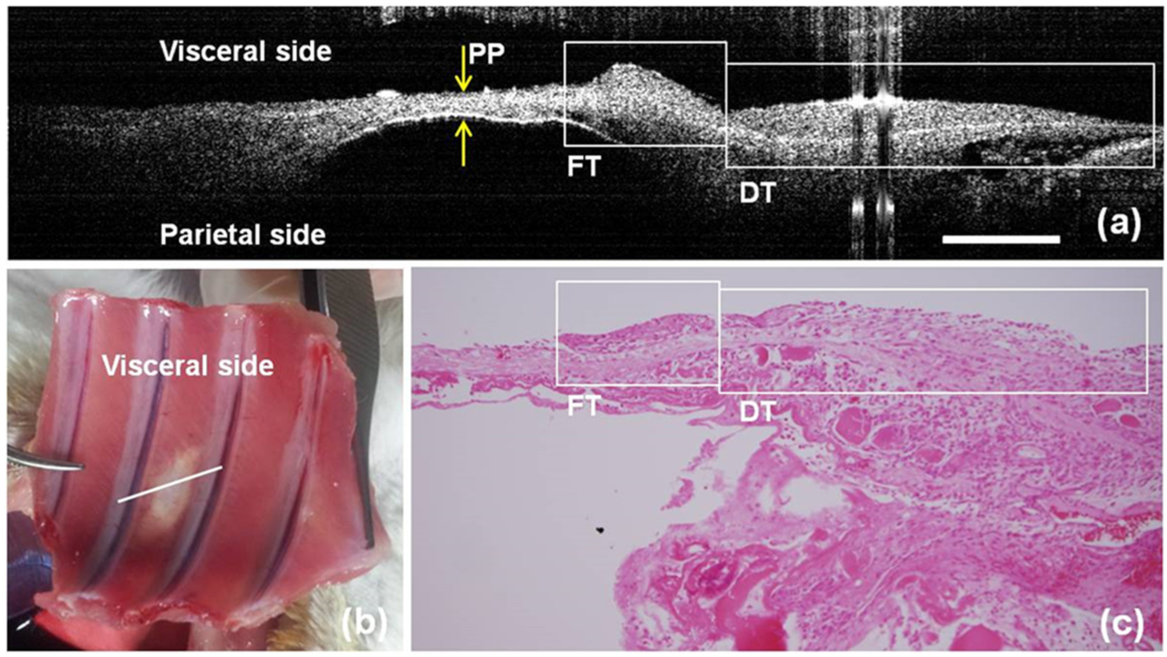 Diagnostics 14 00292 g006 Diagnostics 14 00292 g006