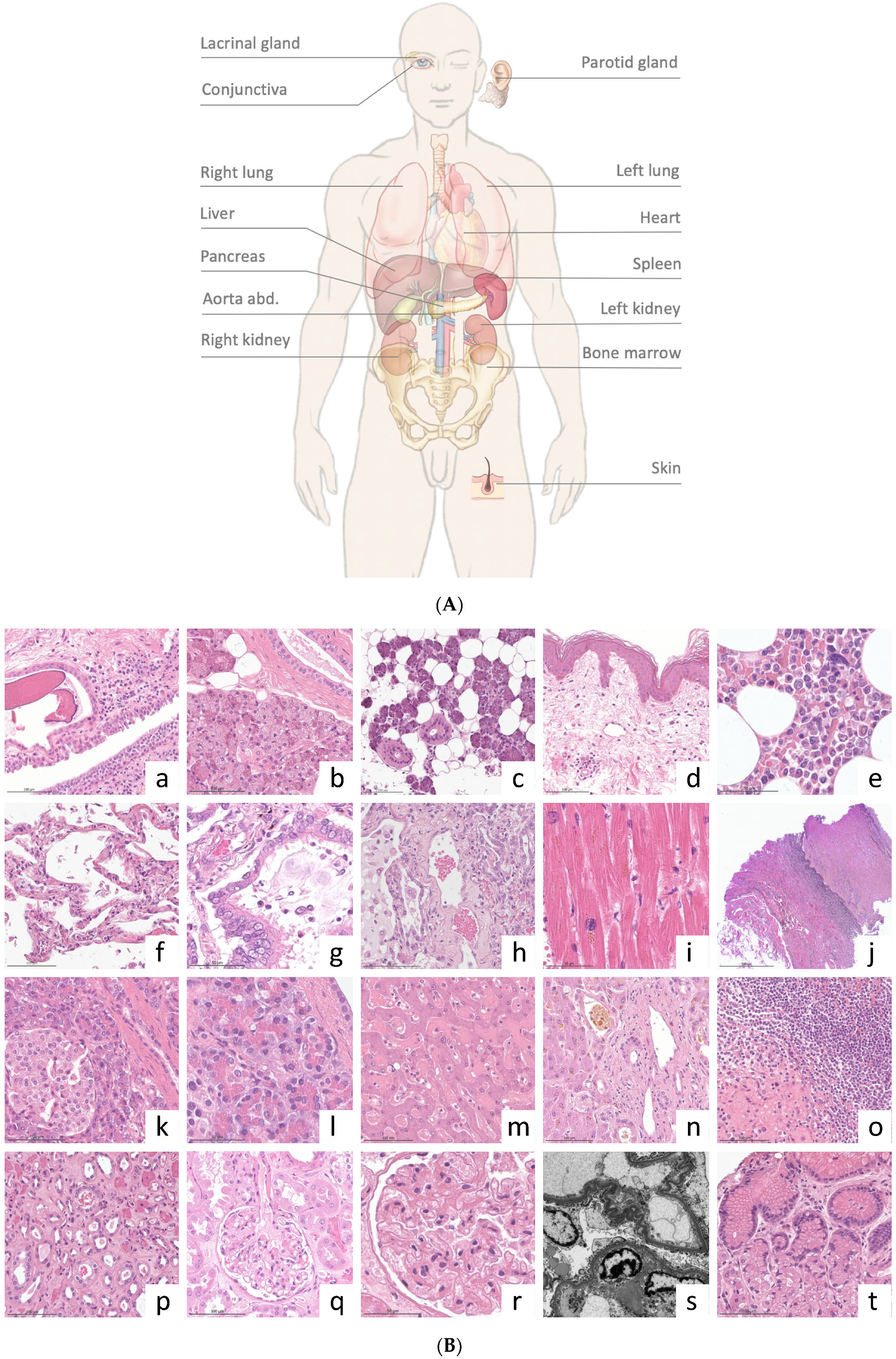 Diagnostics 14 00294 g004