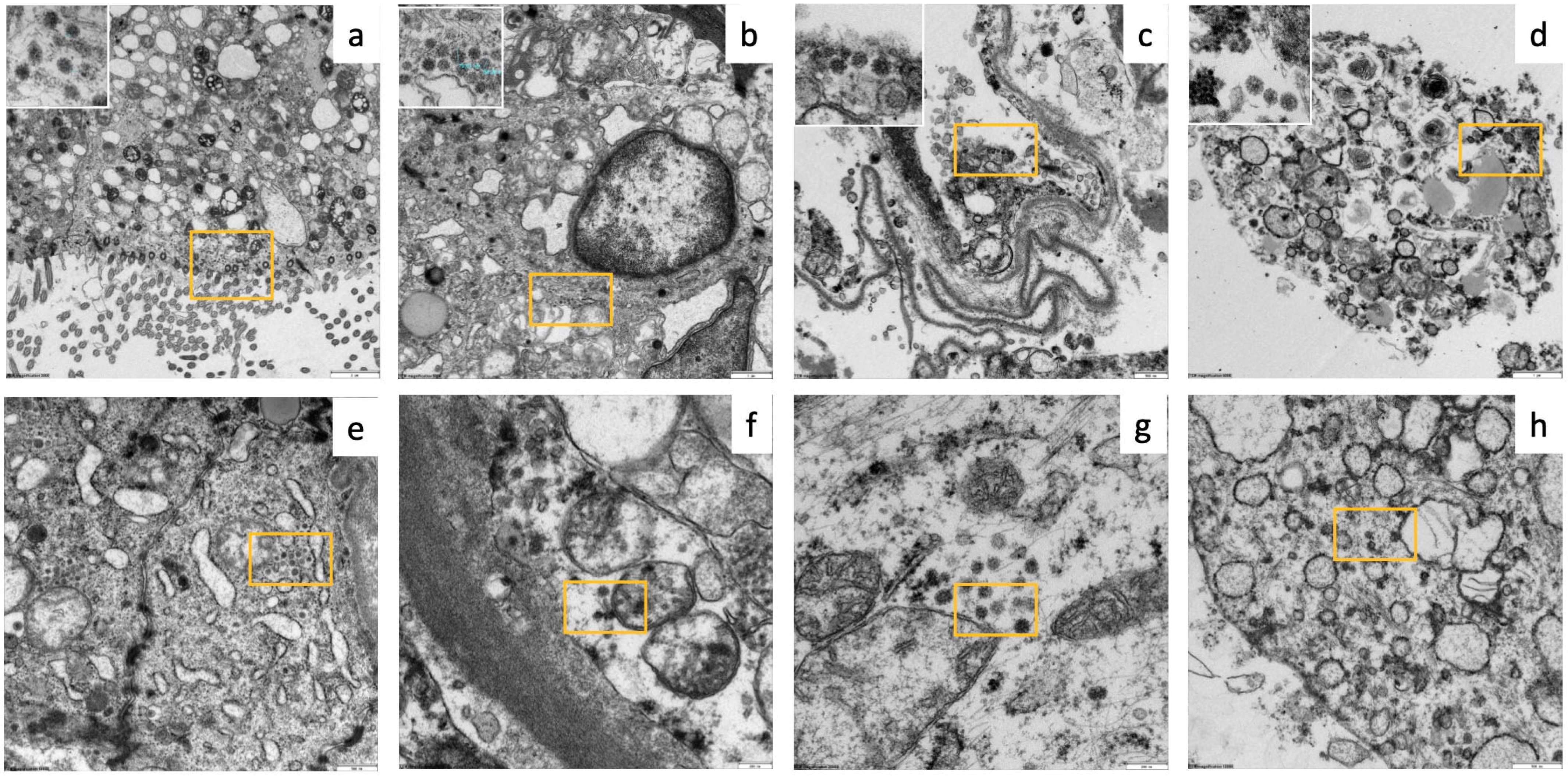 Diagnostics 14 00294 g005