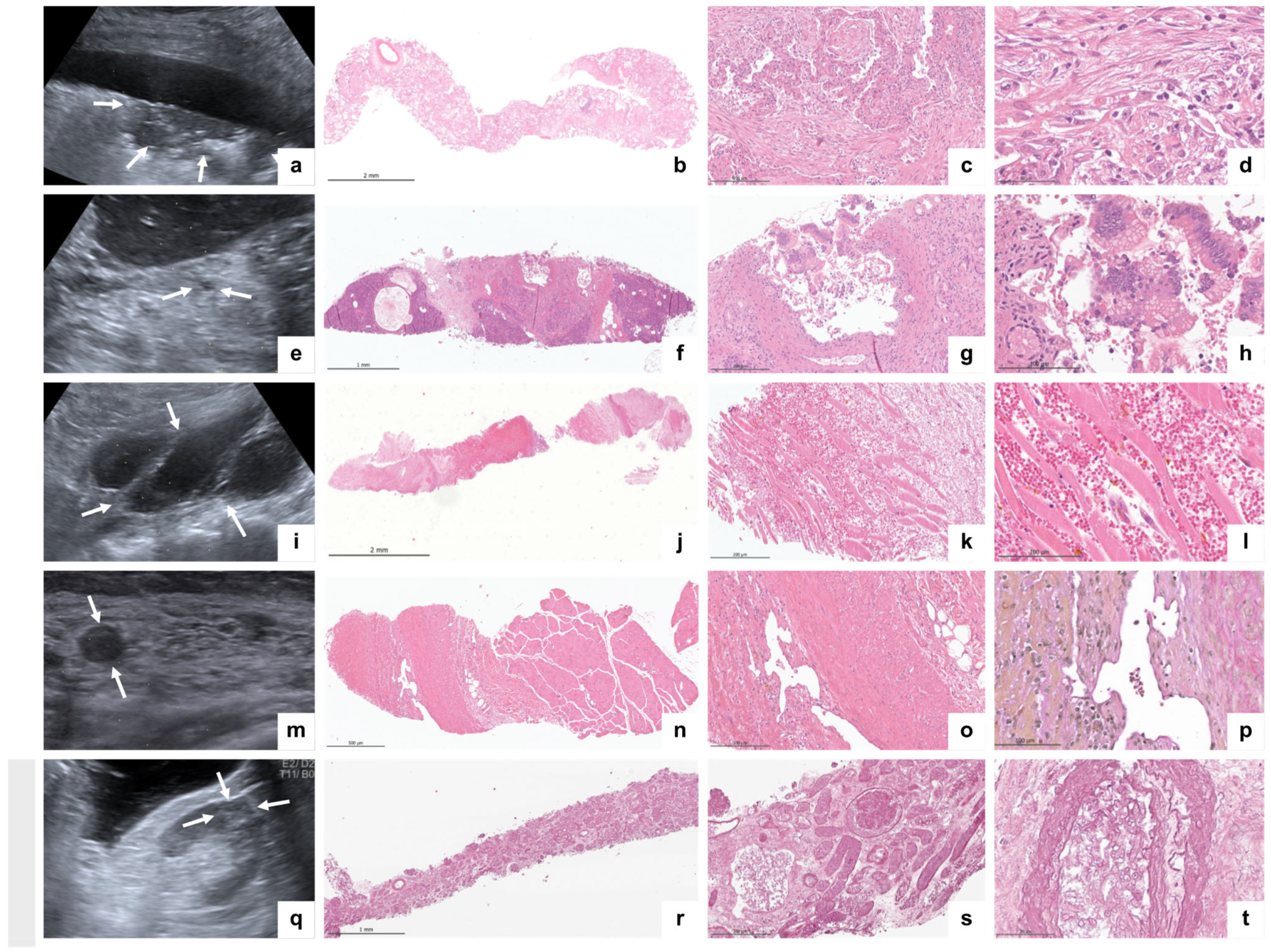 Diagnostics 14 00294 g006