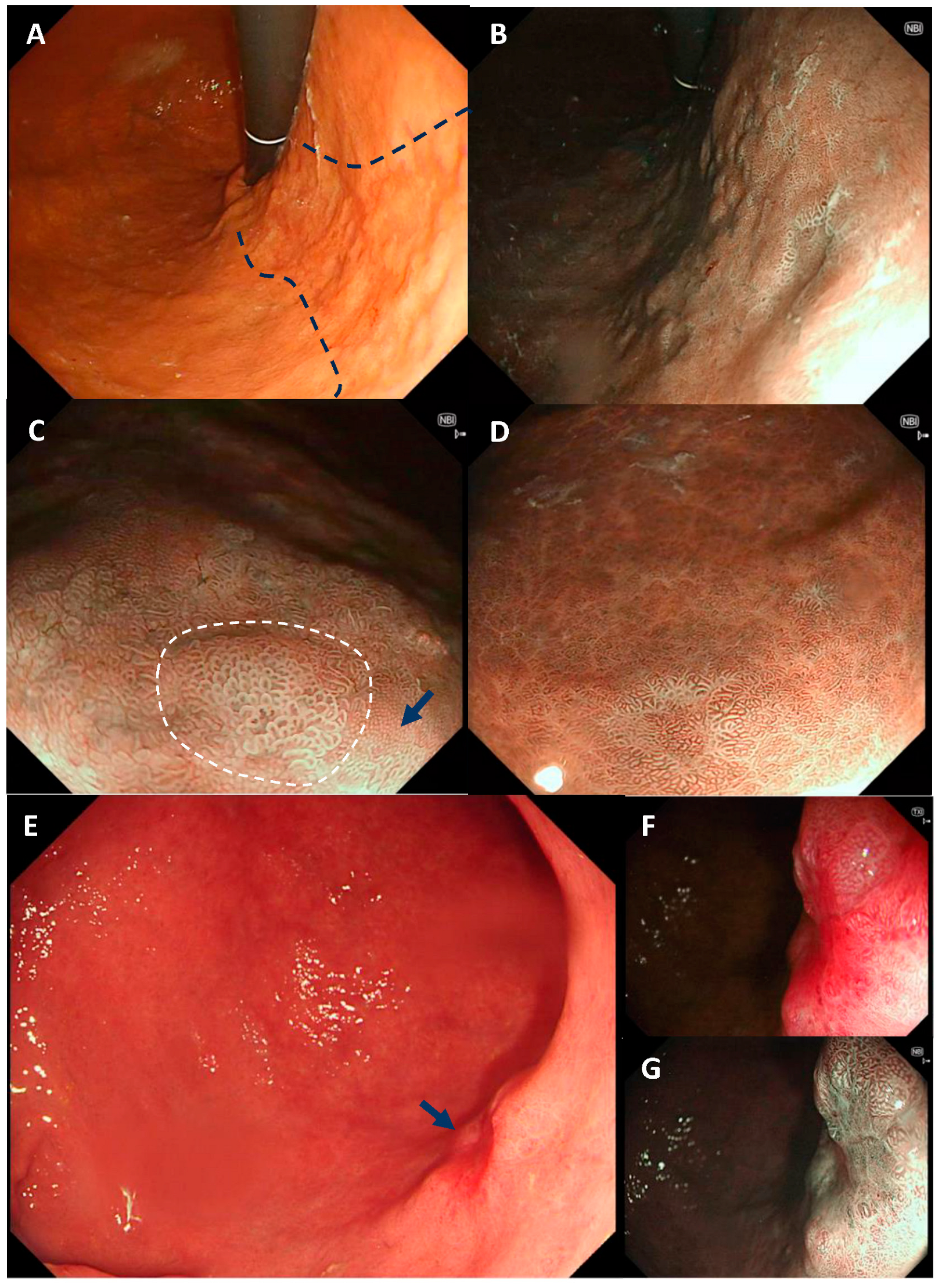 Diagnostics 14 00301 g003 Diagnostics 14 00301 g003