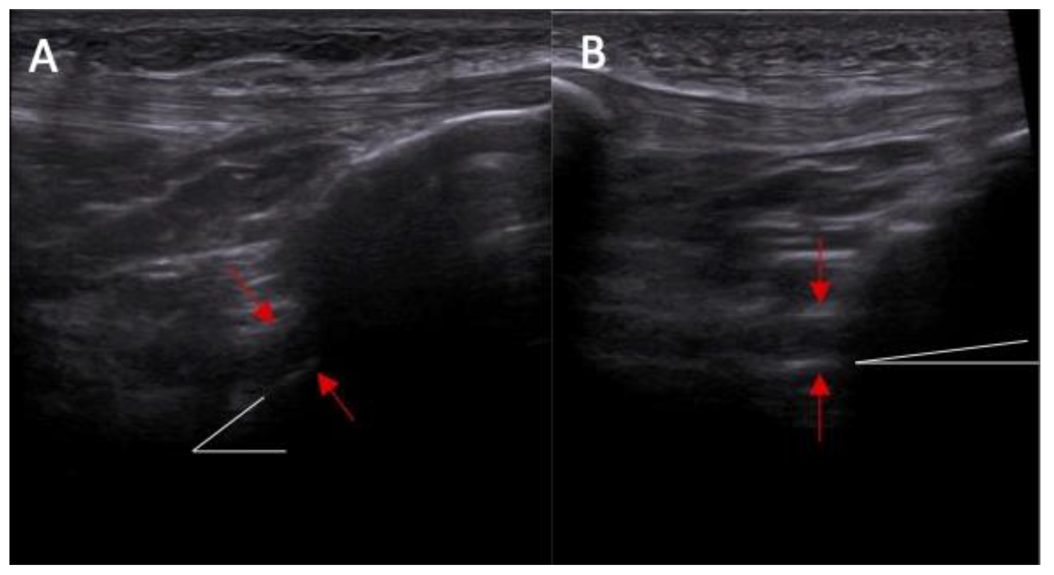 Diagnostics 14 00305 g003
