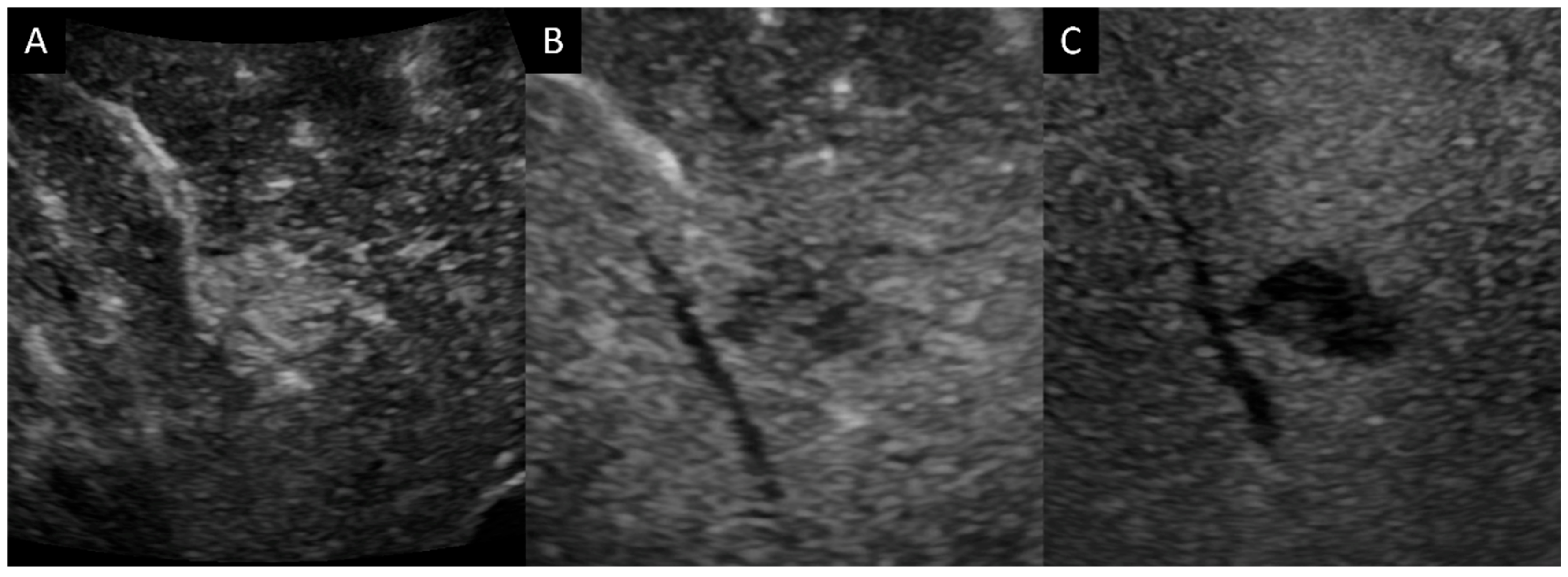Diagnostics 14 00306 g002 Diagnostics 14 00306 g002