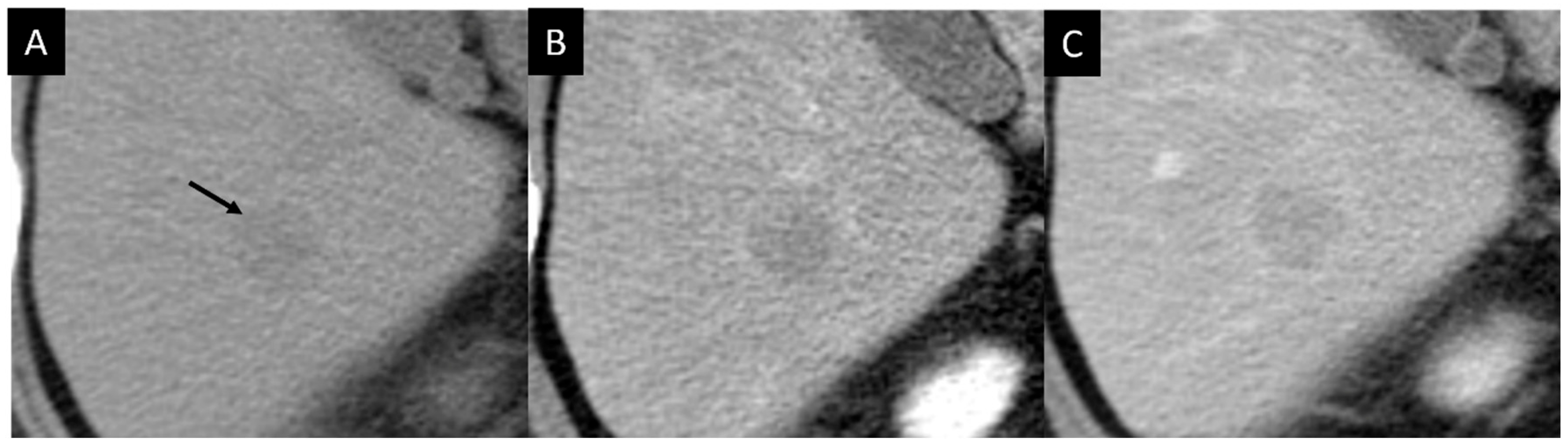 Diagnostics 14 00306 g003 Diagnostics 14 00306 g003