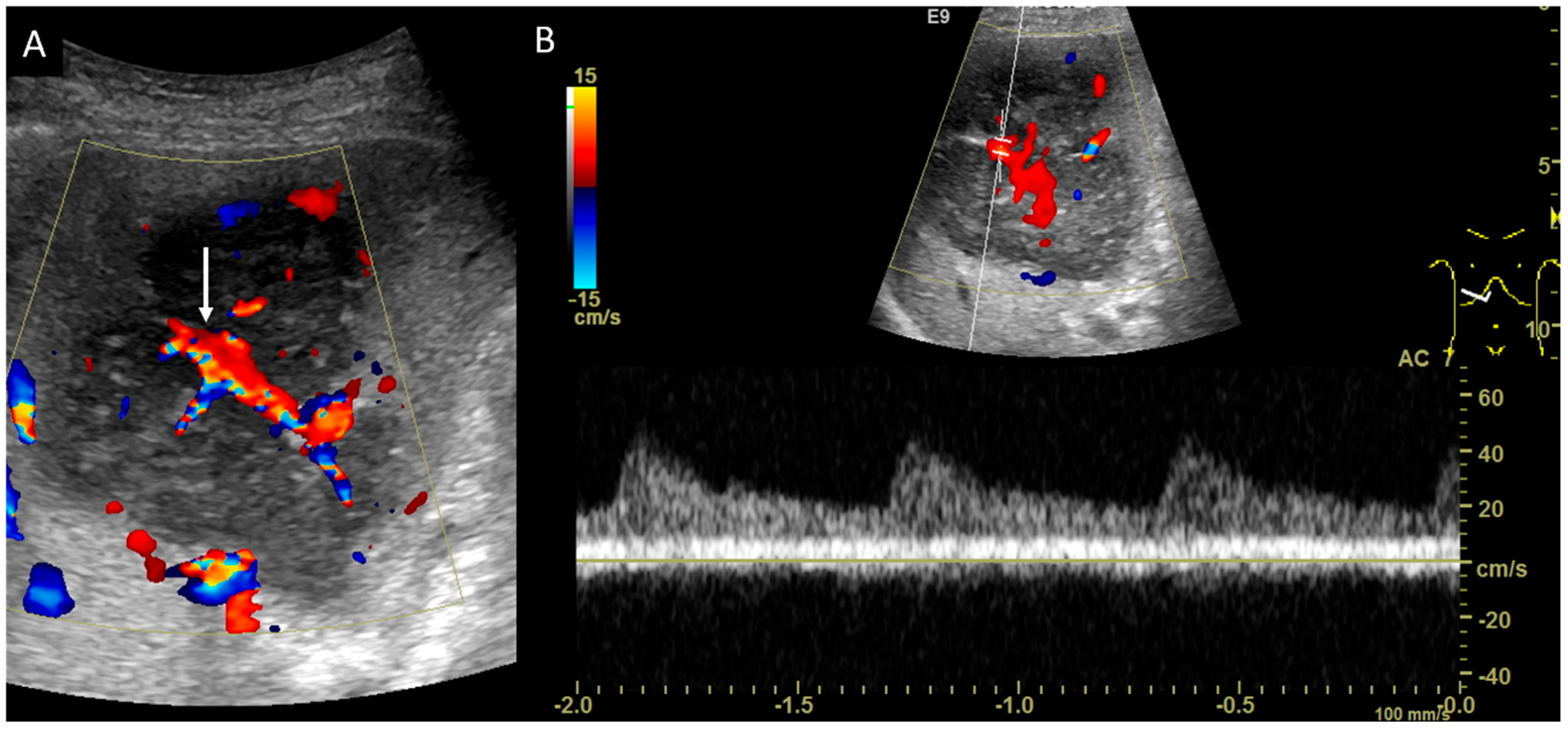 Diagnostics 14 00306 g005 Diagnostics 14 00306 g005