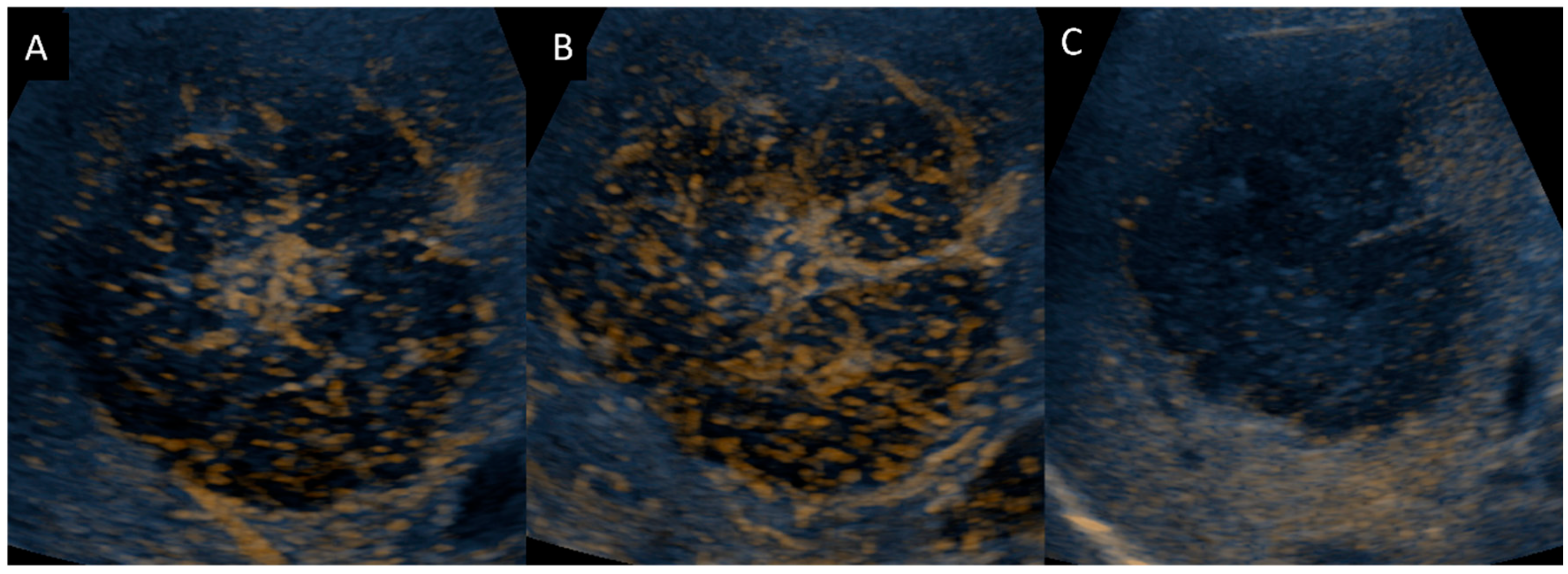 Diagnostics 14 00306 g006 Diagnostics 14 00306 g006