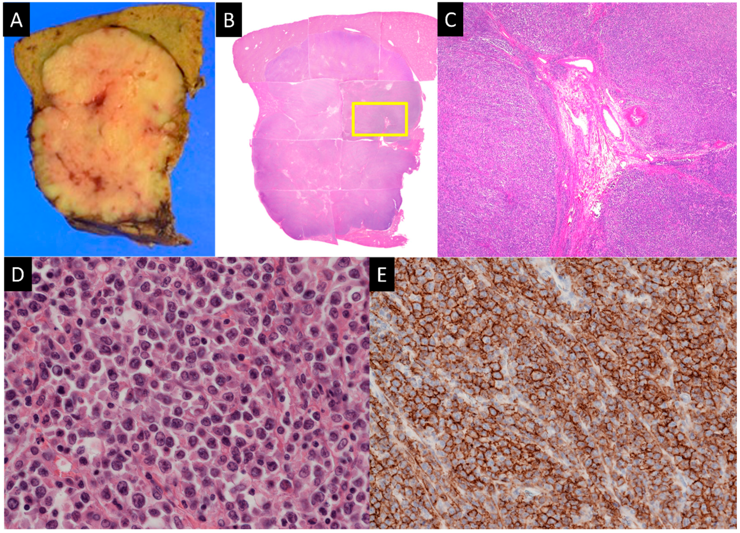 Diagnostics 14 00306 g007 Diagnostics 14 00306 g007