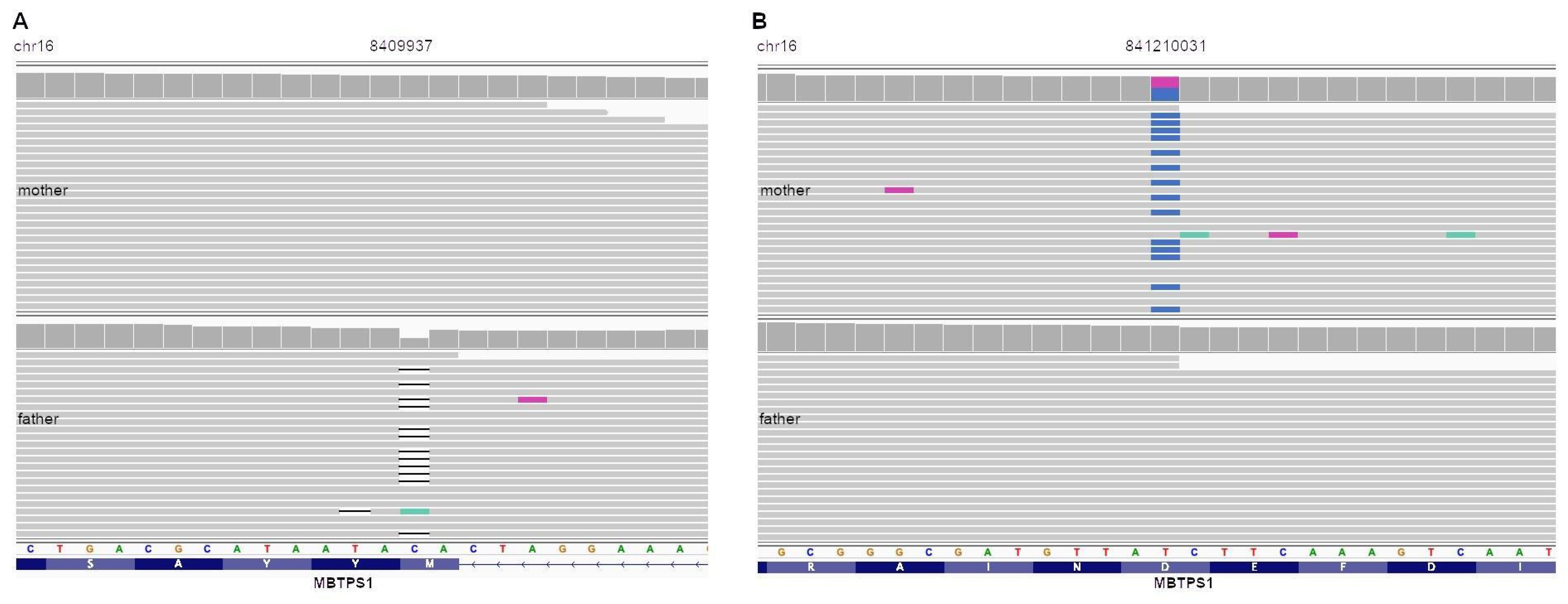 Diagnostics 14 00313 g002