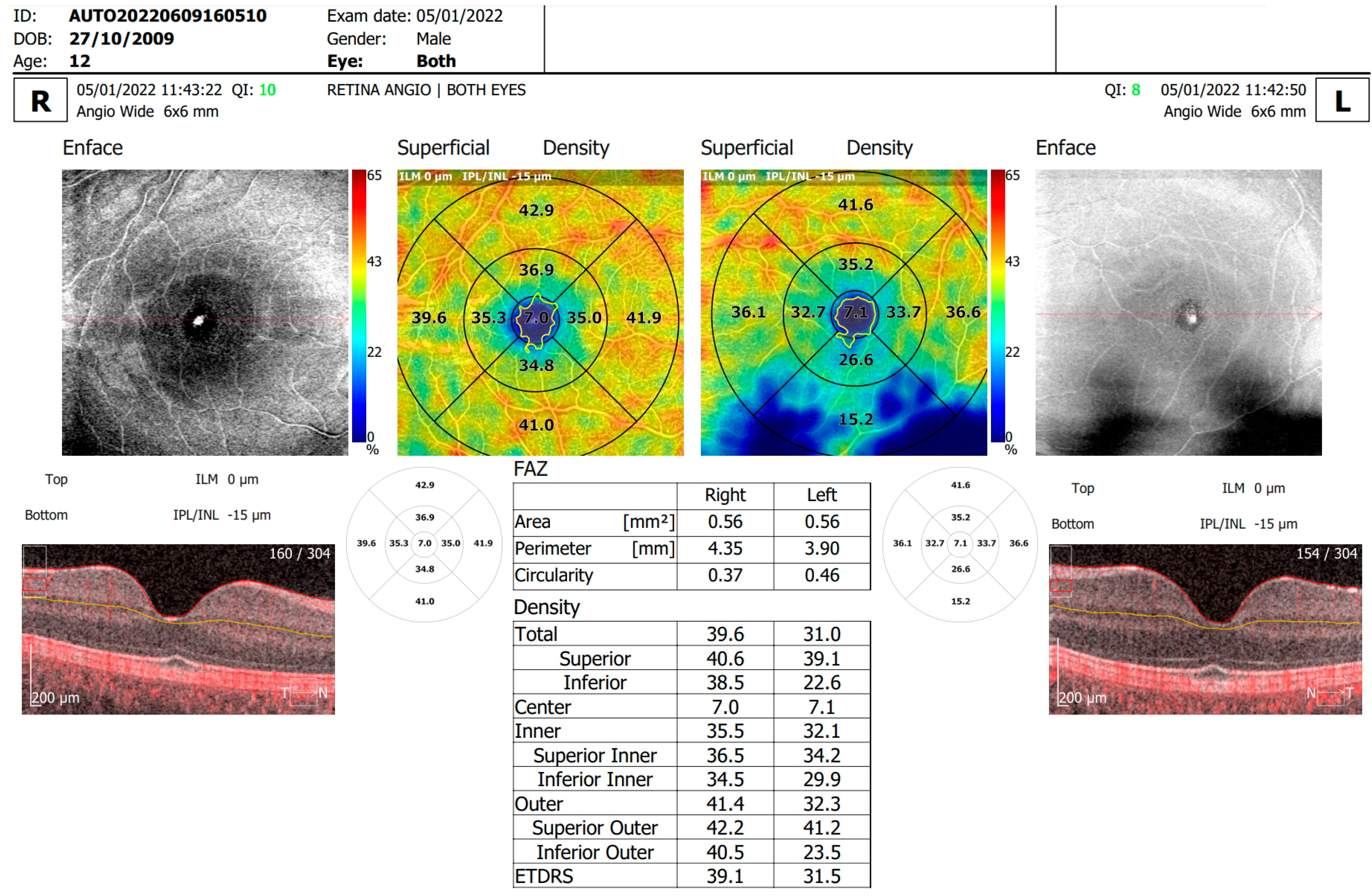 Diagnostics 14 00317 g001