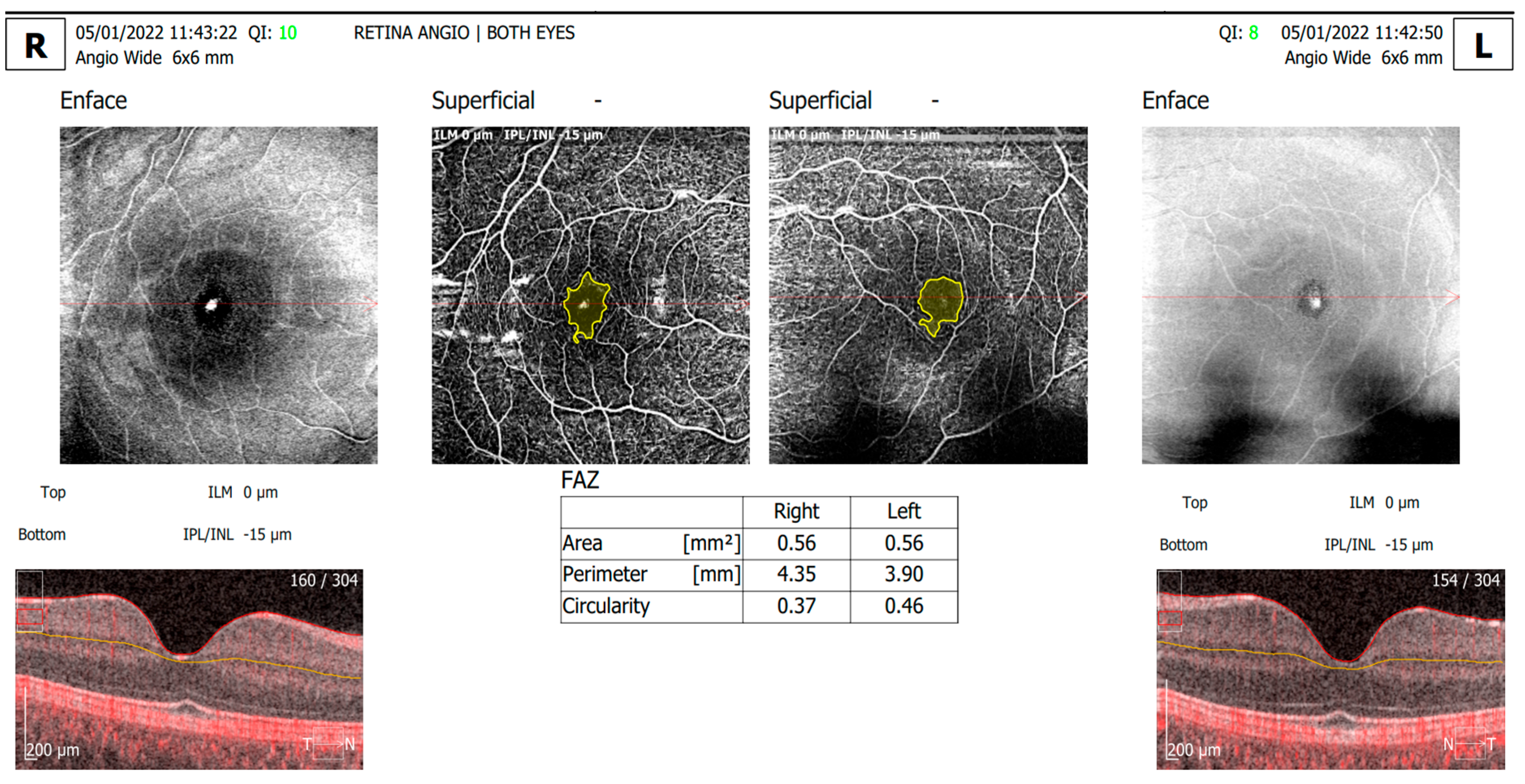 Diagnostics 14 00317 g002