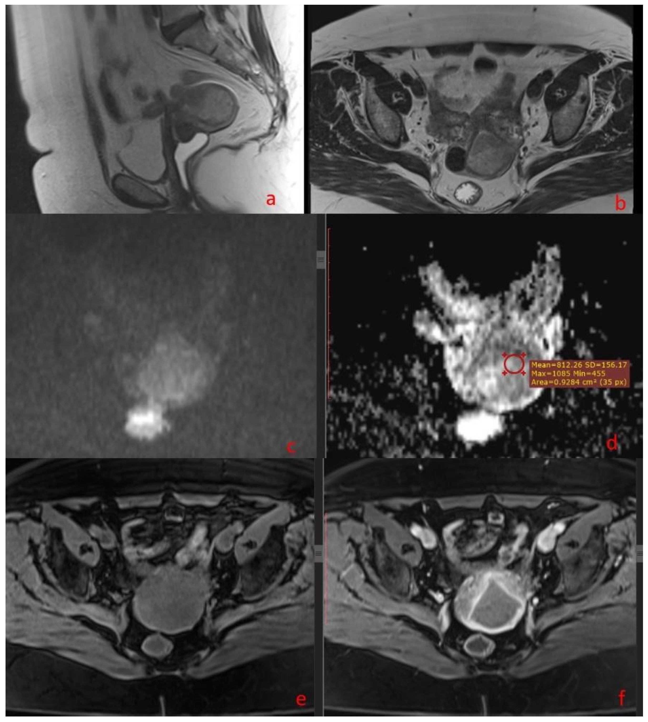 Diagnostics 14 00325 g002