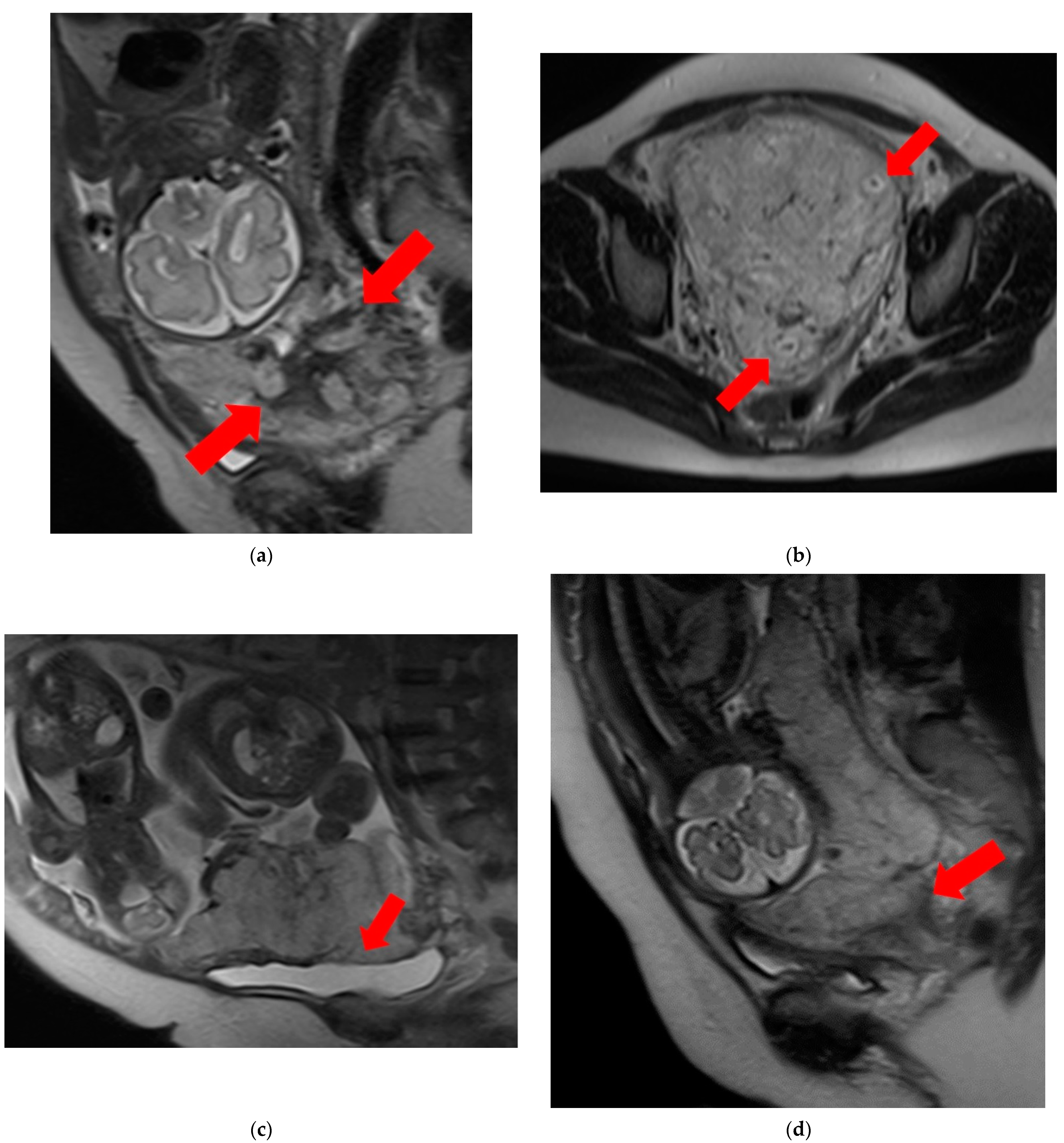 Diagnostics 14 00333 g001a