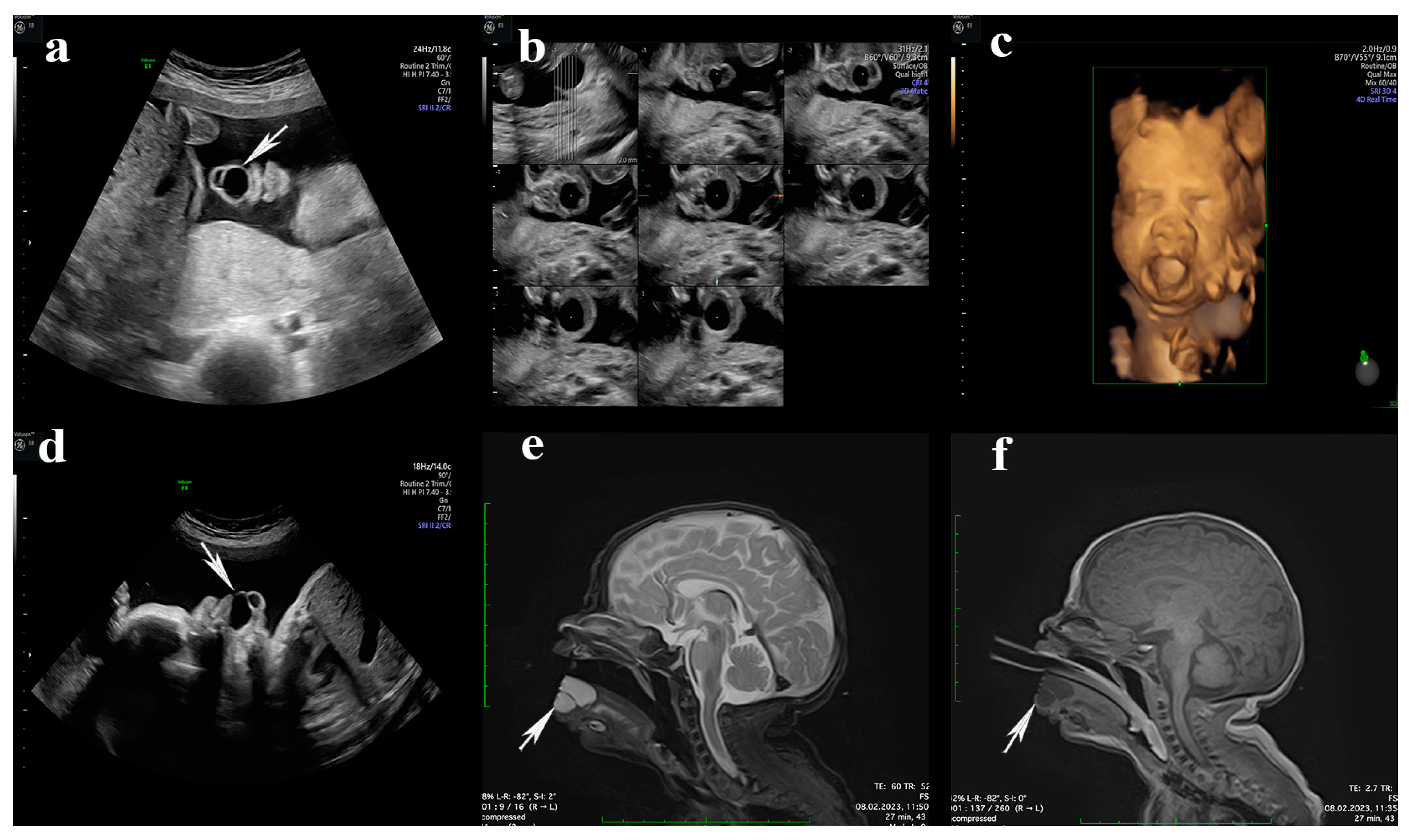 Diagnostics 14 00339 g001 Diagnostics 14 00339 g001