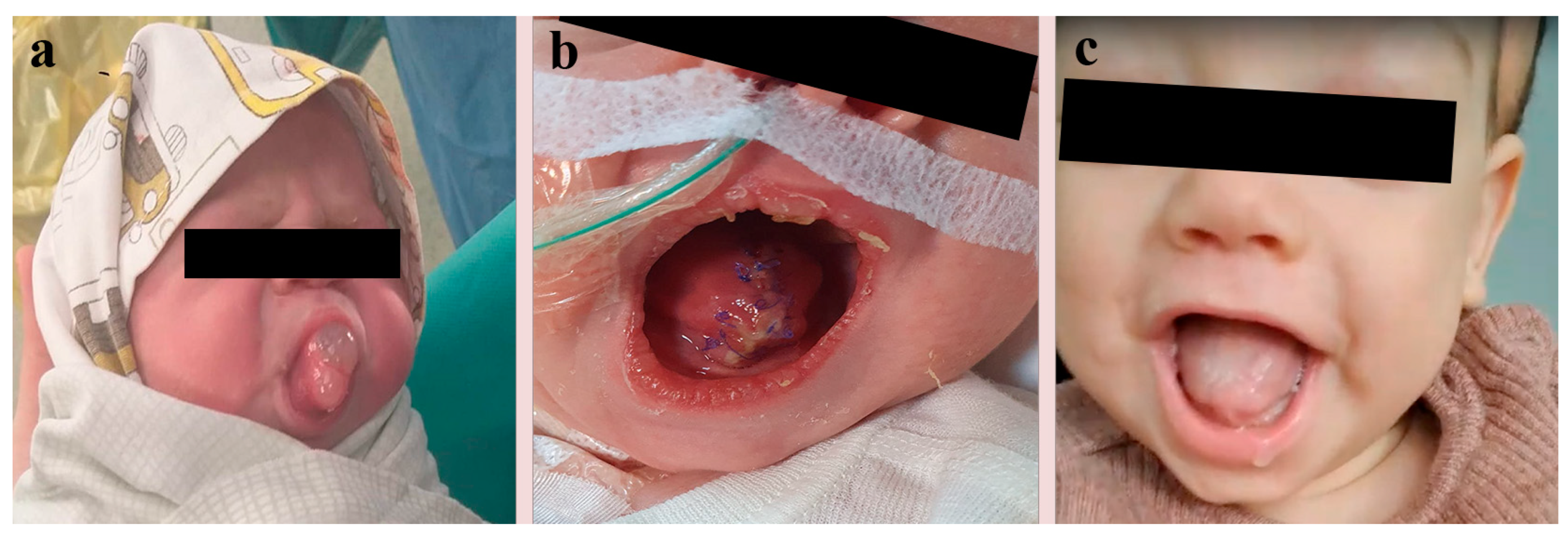 Diagnostics 14 00339 g002 Diagnostics 14 00339 g002
