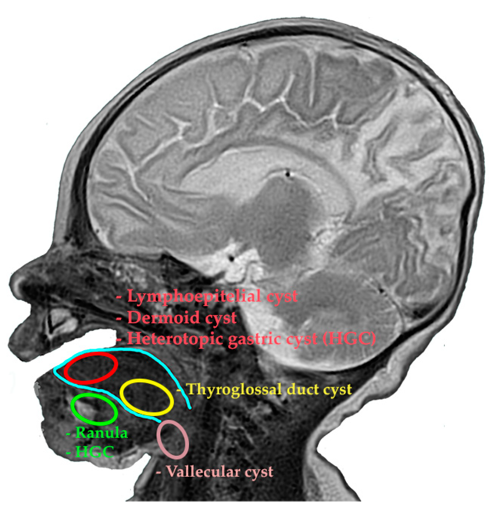 Diagnostics 14 00339 g004 Diagnostics 14 00339 g004