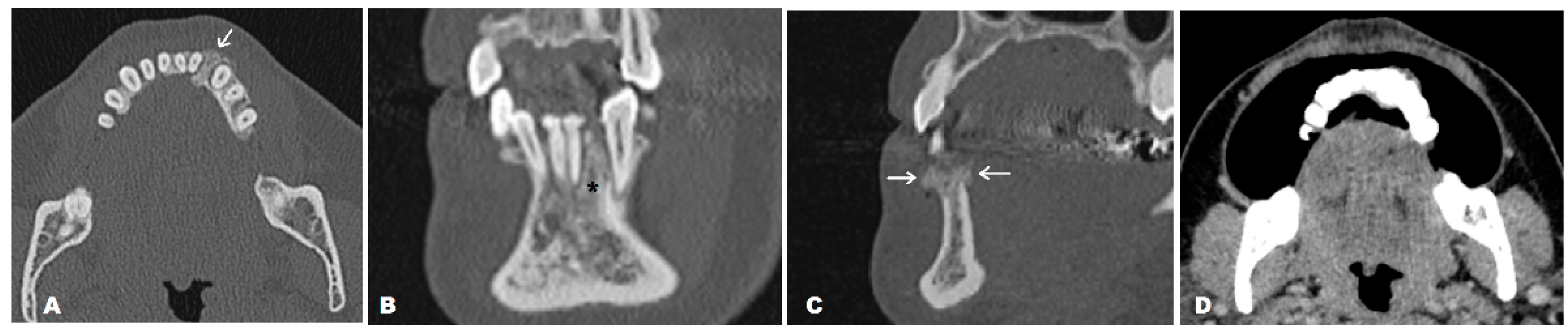 Diagnostics 14 00348 g002