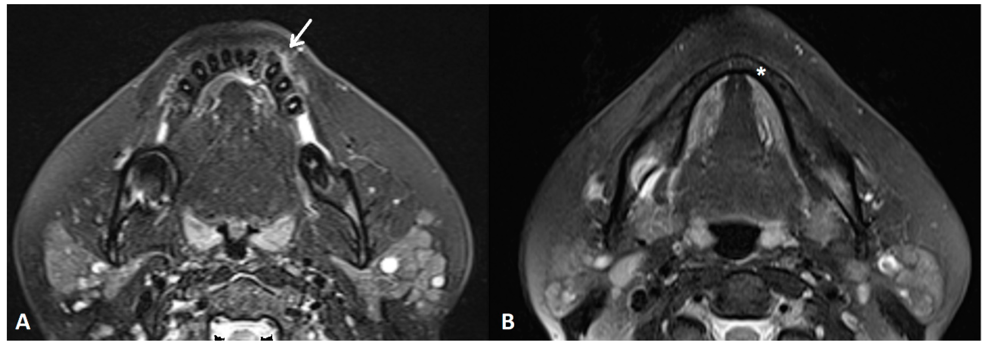 Diagnostics 14 00348 g003