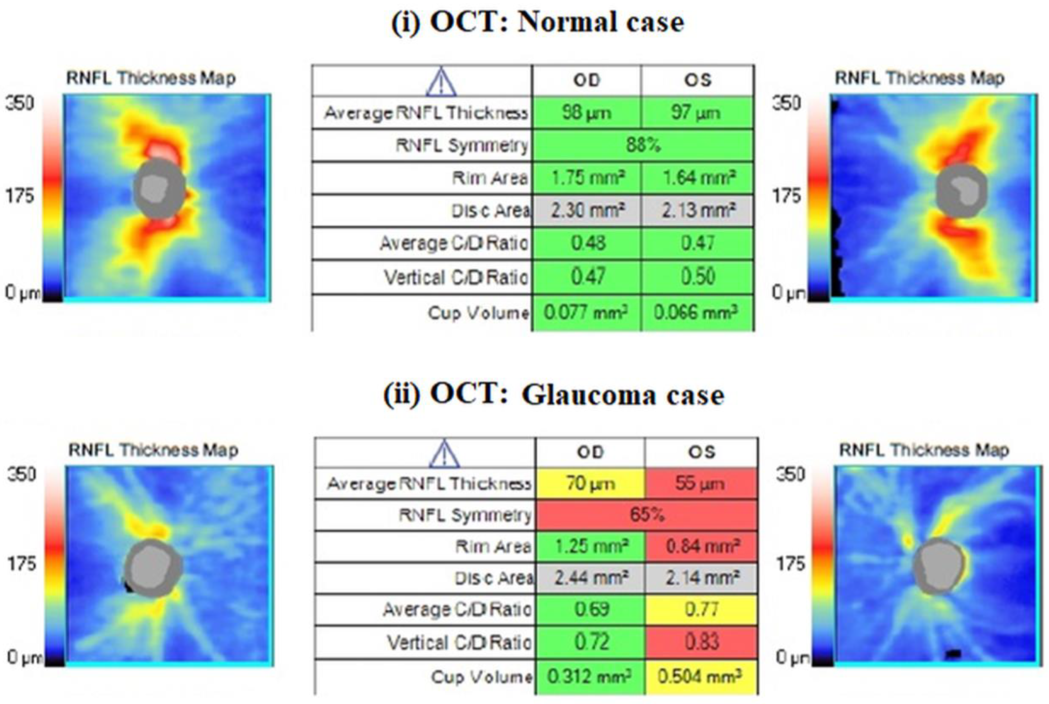 Diagnostics 14 00349 g002 Diagnostics 14 00349 g002