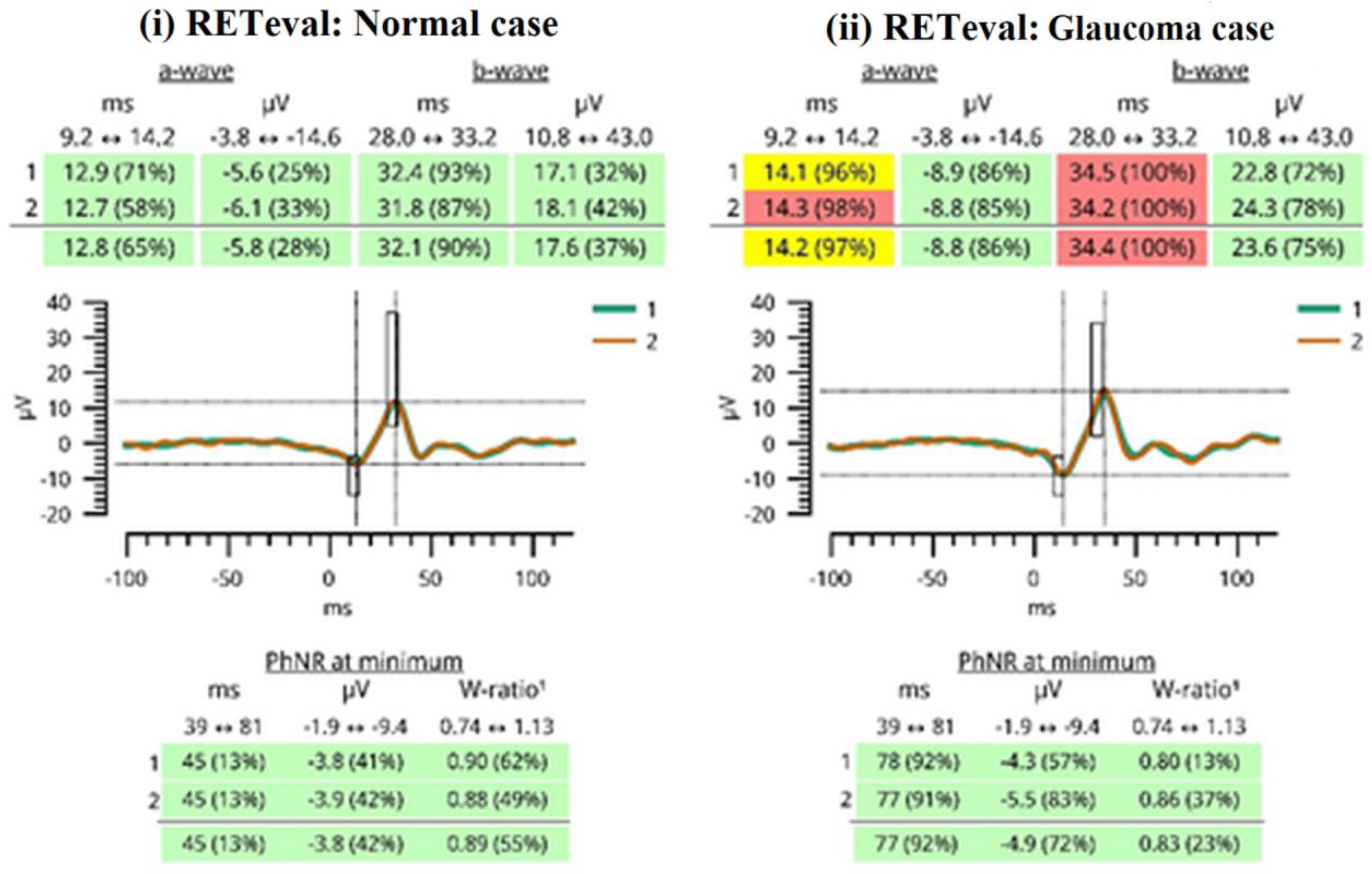 Diagnostics 14 00349 g003 Diagnostics 14 00349 g003
