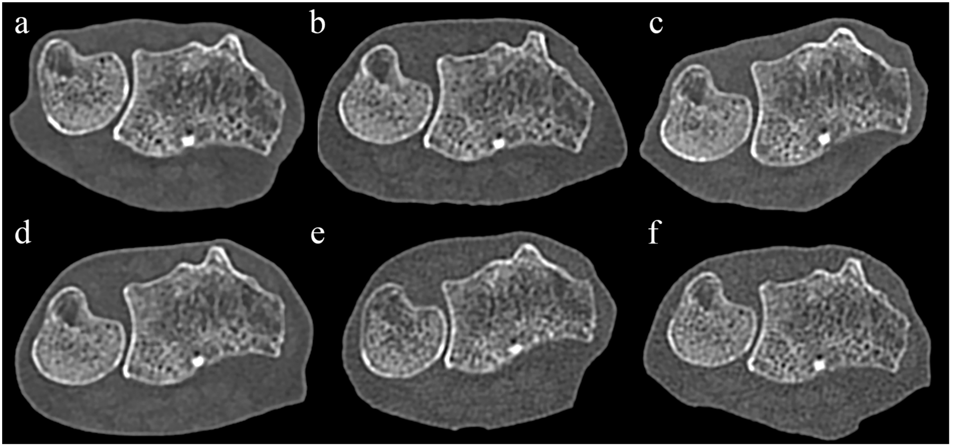 Diagnostics 14 00350 g001