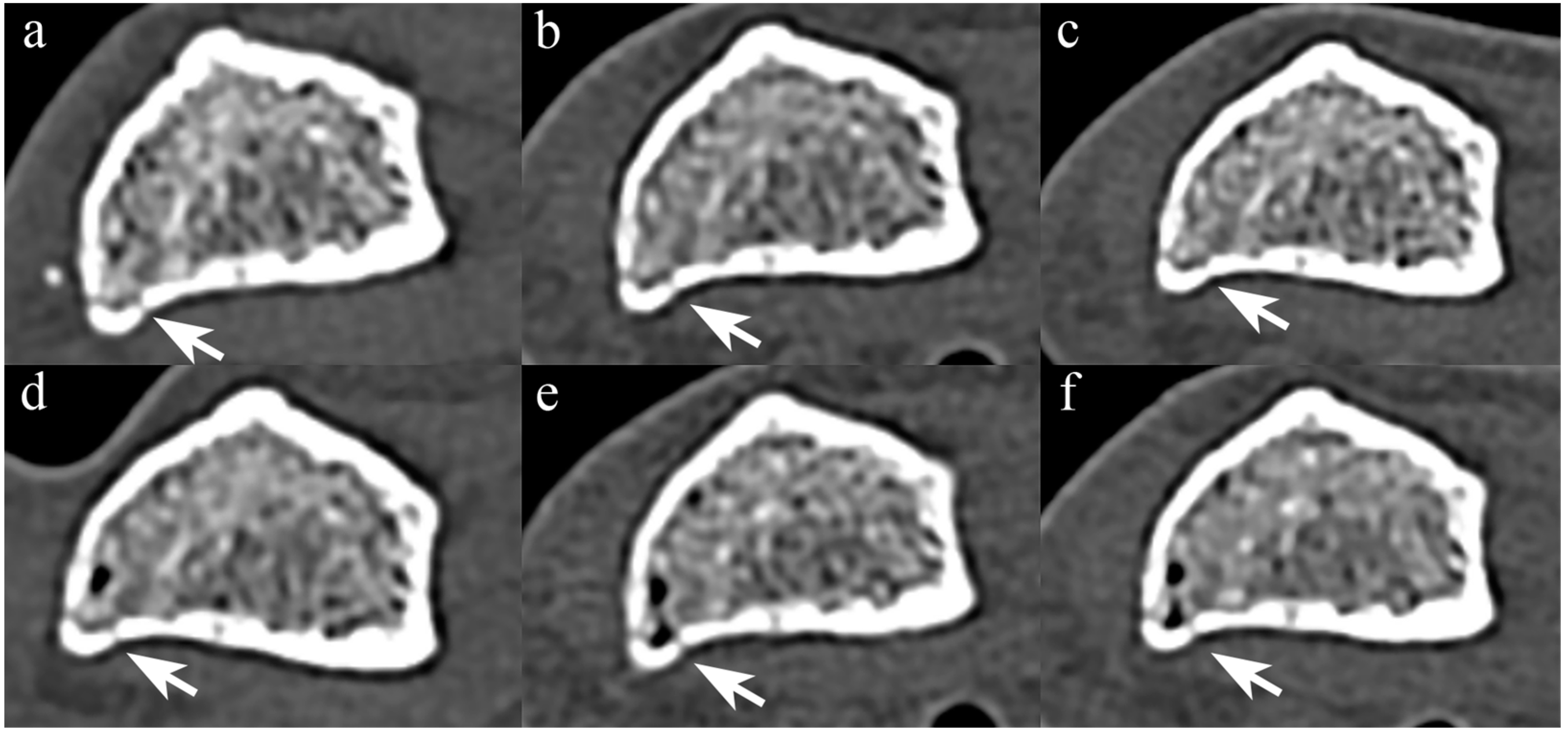 Diagnostics 14 00350 g003